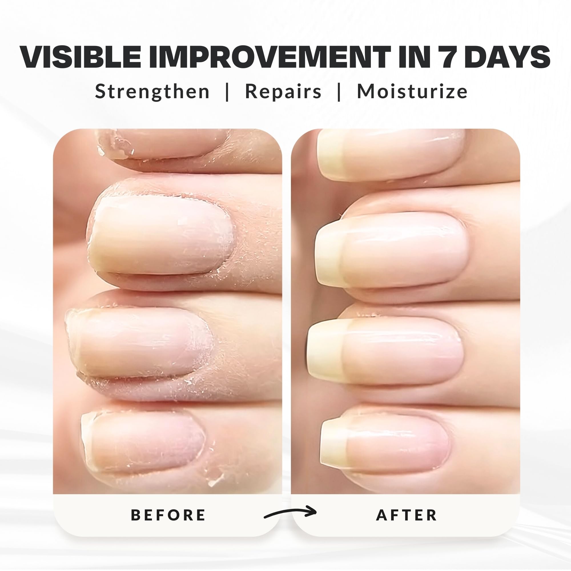CAKE Nail Power Boost: Strengthener with Keratin, Biotin & Vitamin E | Base Coat & Top Coat