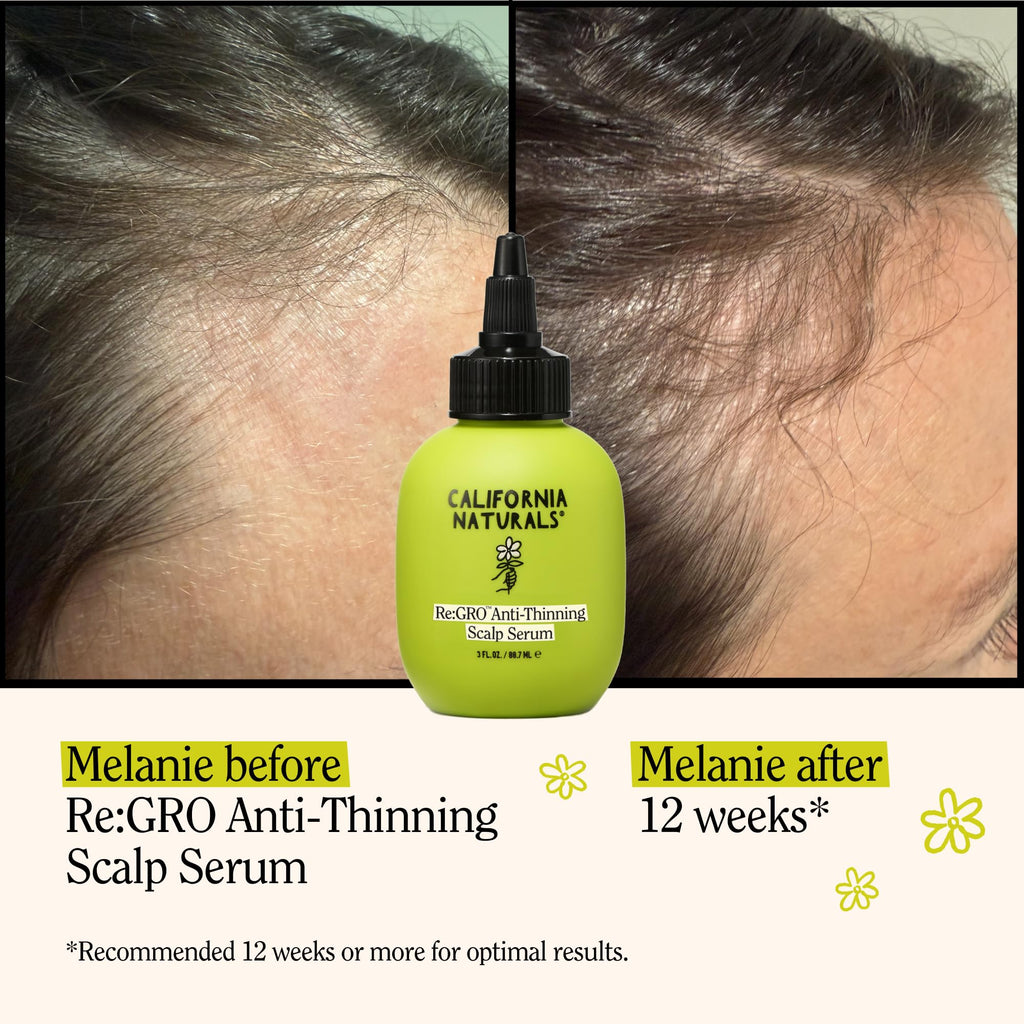 California Naturals Re:GRO Anti-Thinning Scalp Serum – 5% Capixyl, 3oz