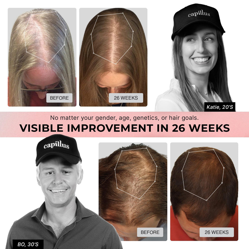 Capillus Pro S1 Red Light Therapy Cap for Hair Growth | FDA-Cleared LLLT