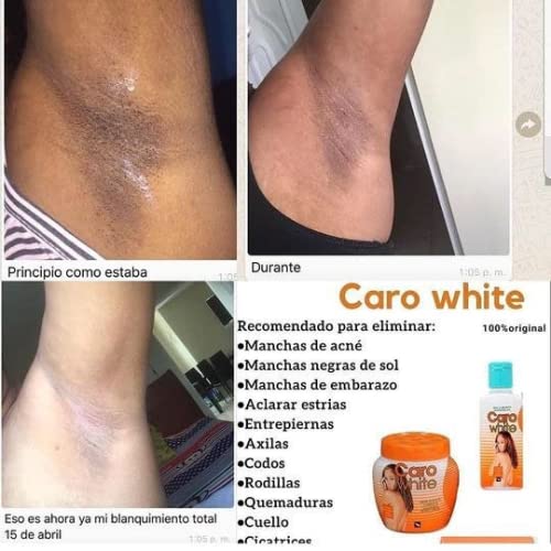 Caro White Set-3: Lotion, Cream & Soap – 10.14oz, 10.14oz & 6.3oz