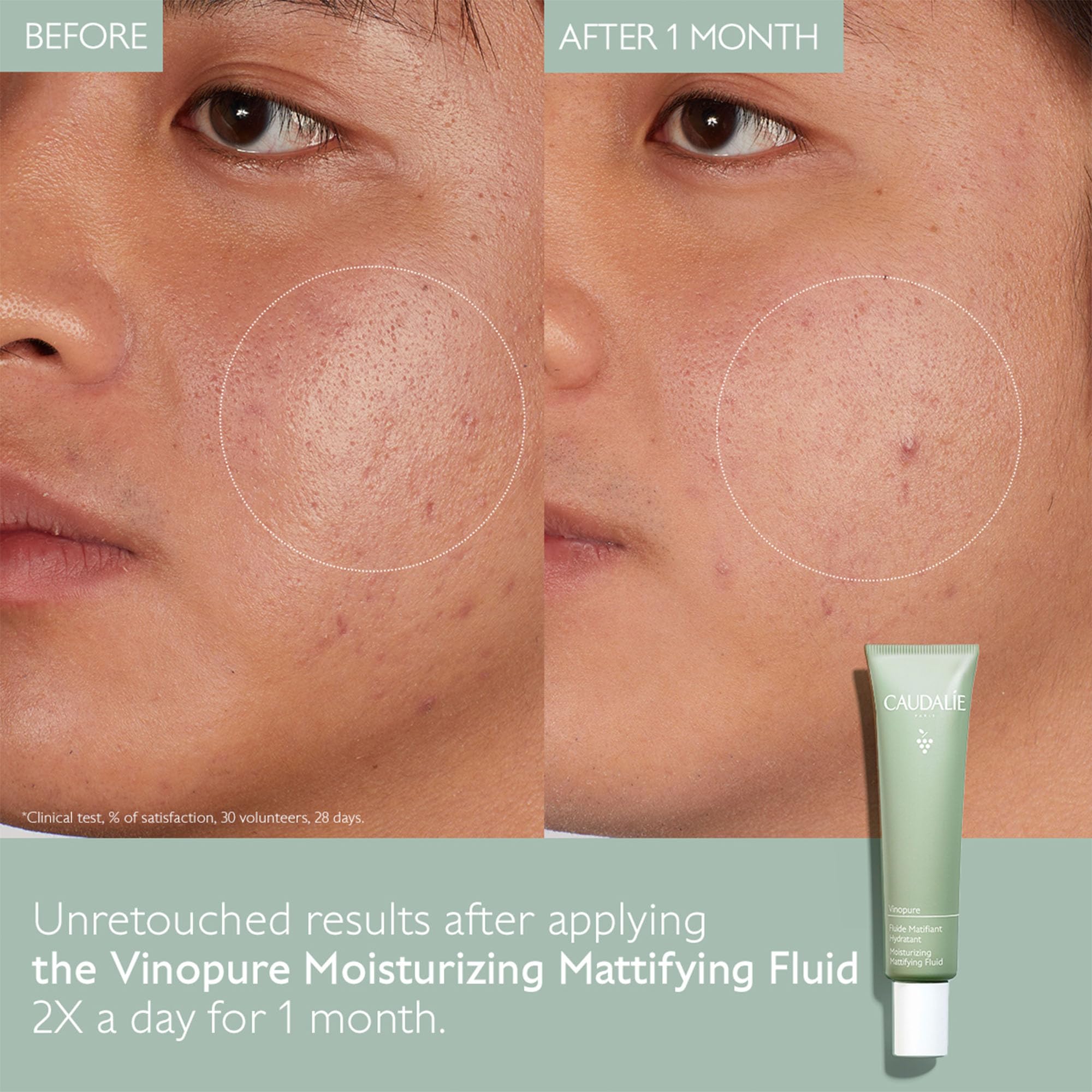 Caudalie Vinopure Oil Control Moisturizer – Hydrating & Mattifying Gel (40 mL)