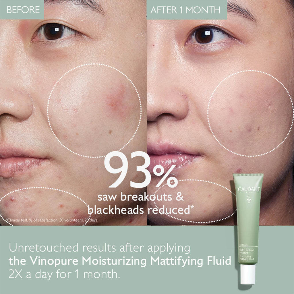 Caudalie Vinopure Oil Control Moisturizer – Hydrating & Mattifying Gel (40 mL)