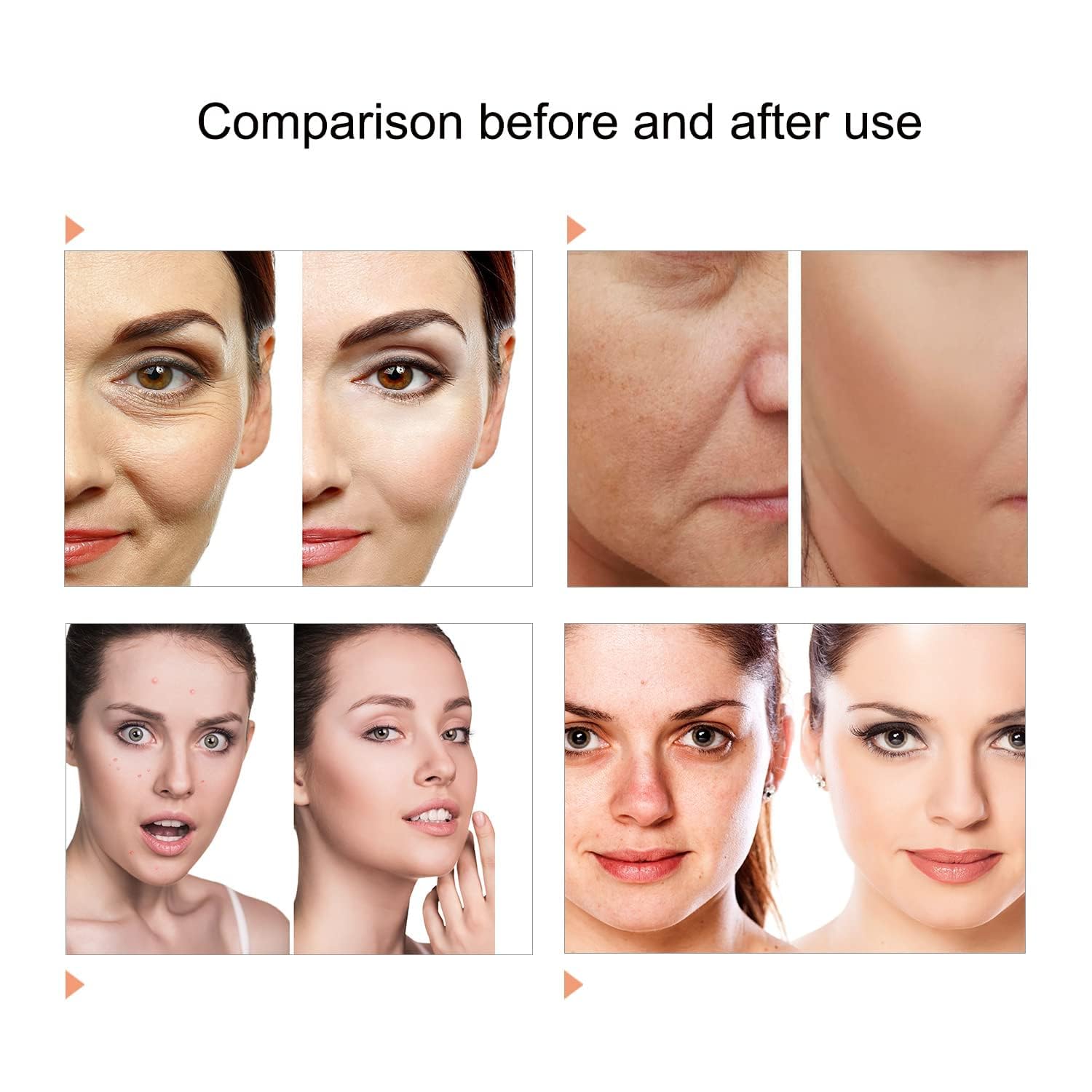 Caweiya 7 Color LED Face Mask | Home Skin Care Light Therapy