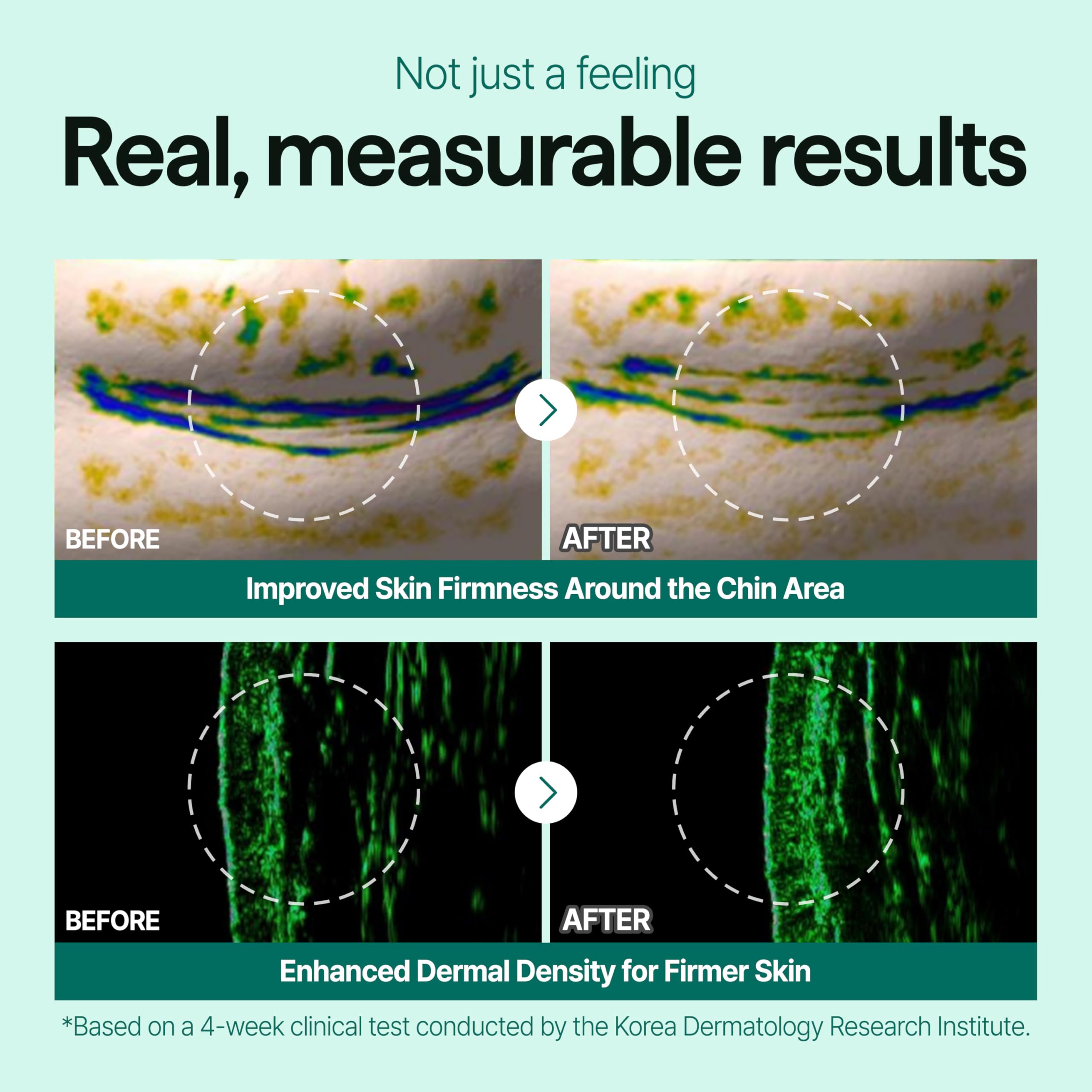 CELL IN SHOT Mumak Stem Shot – Skin Lifting & Elasticity Booster with MFSC® Stem Cell Technology
