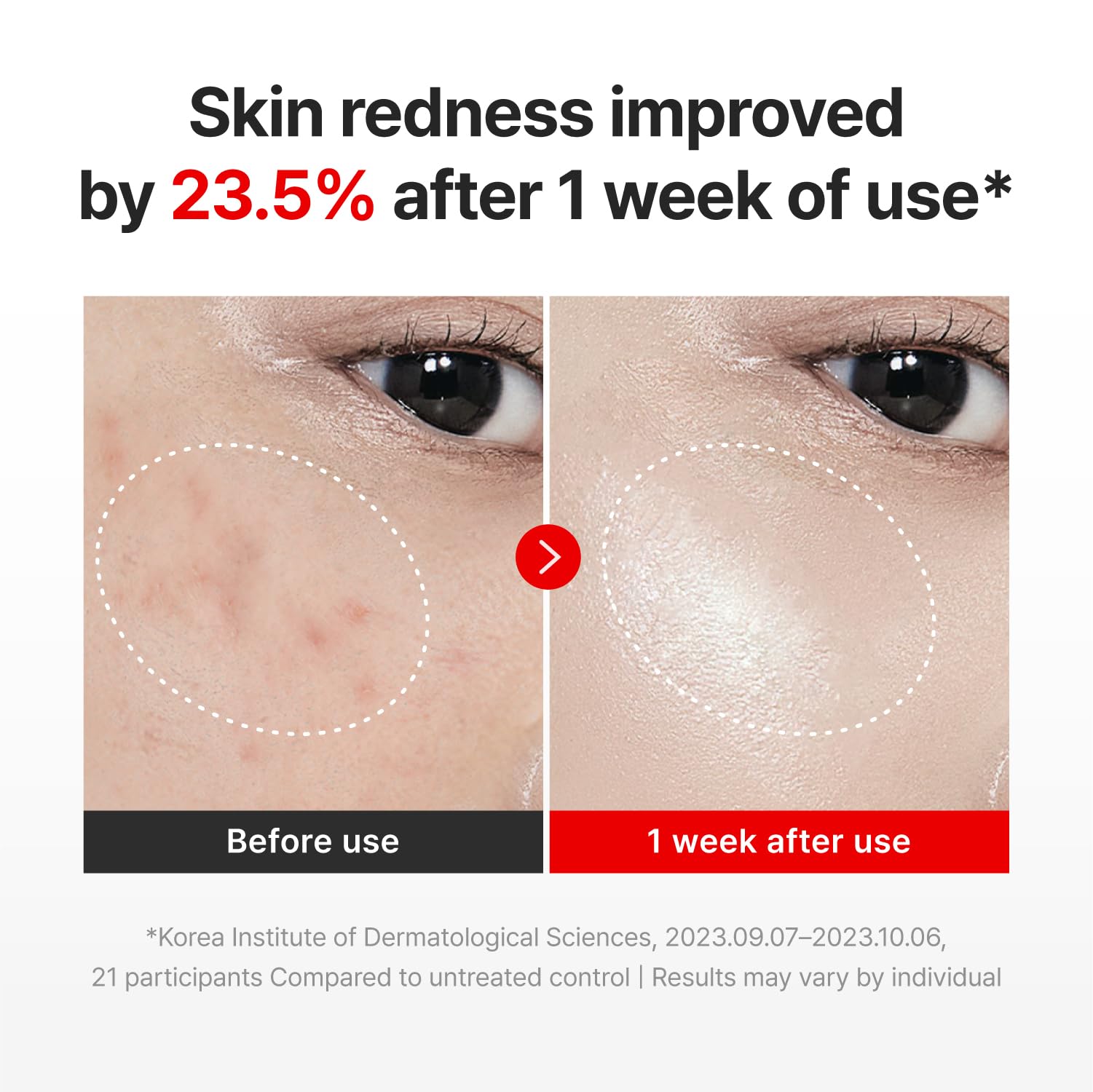 CENTELLIAN 24 Madeca Cream Time Reverse Full Moon Edition (2-Pack) – Deep Hydration, Firming & TECA 30,000ppm