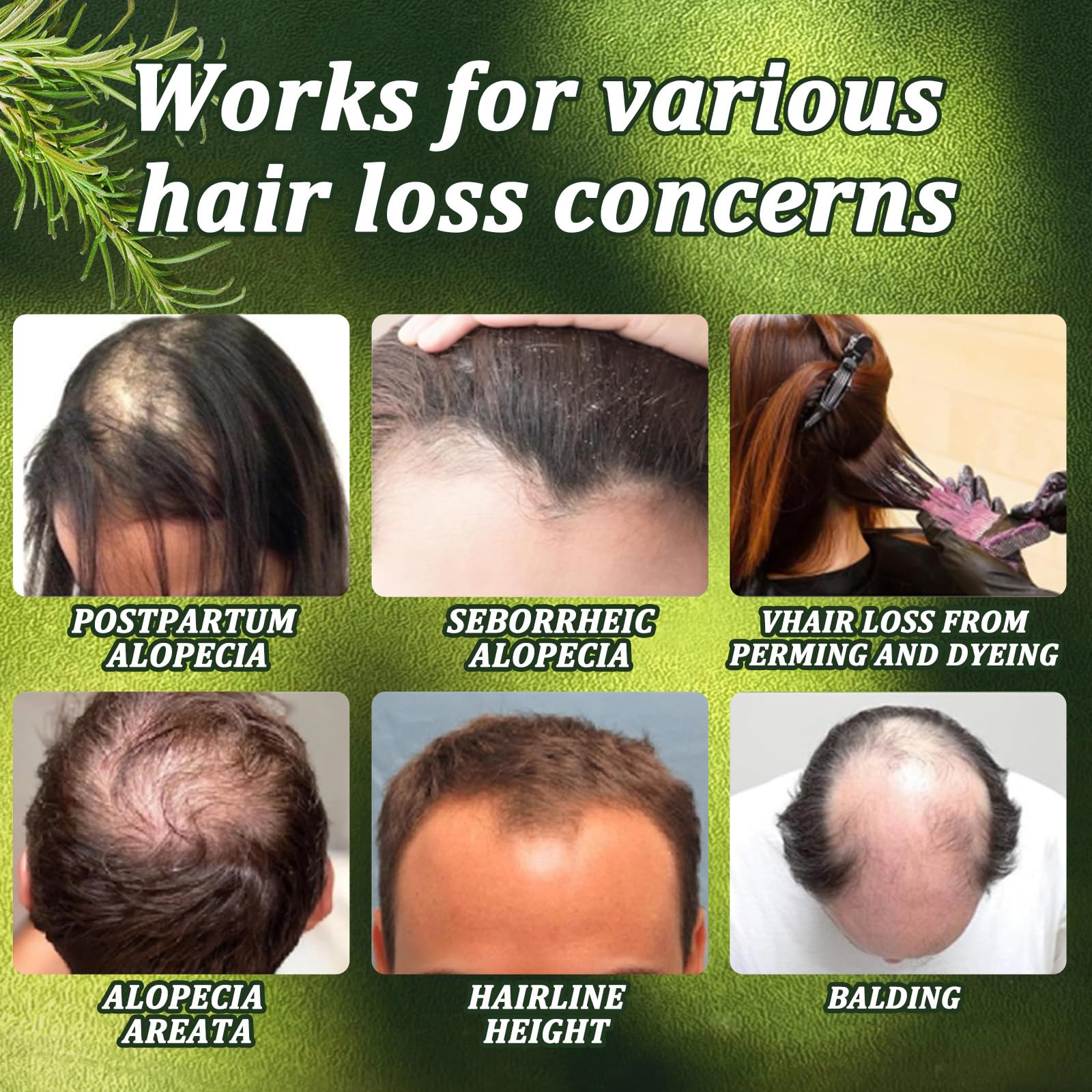 Chambelza Organic Rosemary Hair Growth Shampoo for Men and Women – Biotin & Hydrolyzed Keratin, 2-Pack