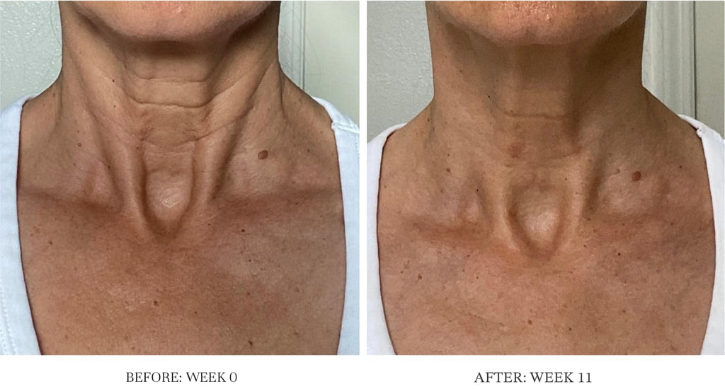 City Beauty Ultra-Firming Dry Oil – Neck & Décolletage Lift & Hydration