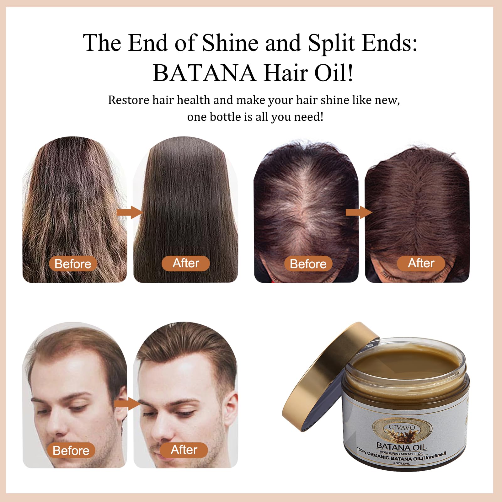 Civavo Organic Batana Oil Hair Mask – 100% Pure Nourishing Pressed Oil for Hair & Skin (4 oz)