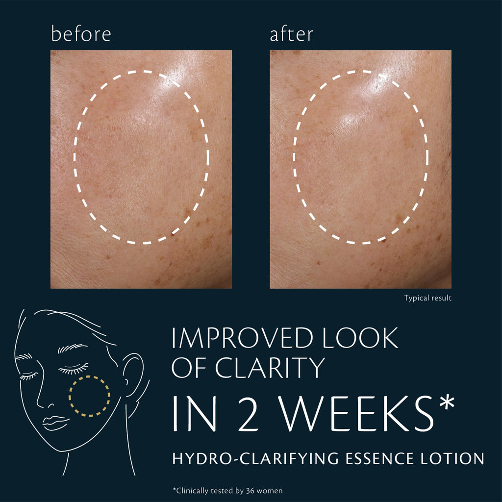 Clé de Peau Beauté Hydro-Clarifying Essence Lotion – Hydration & Refinement for Normal to Oily Skin