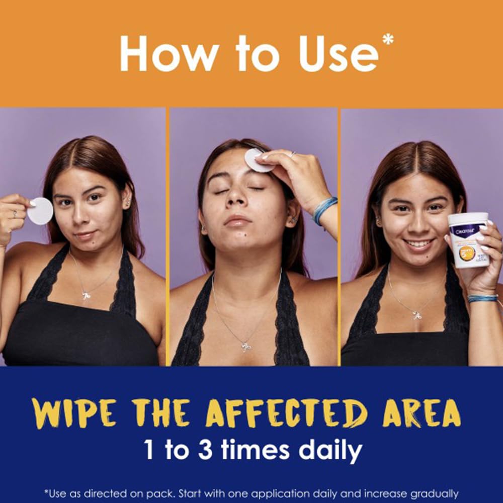 Clearasil 5-in-1 Acne Treatment Pads — Stubborn Acne Control, 90 Pads (3-Pack)