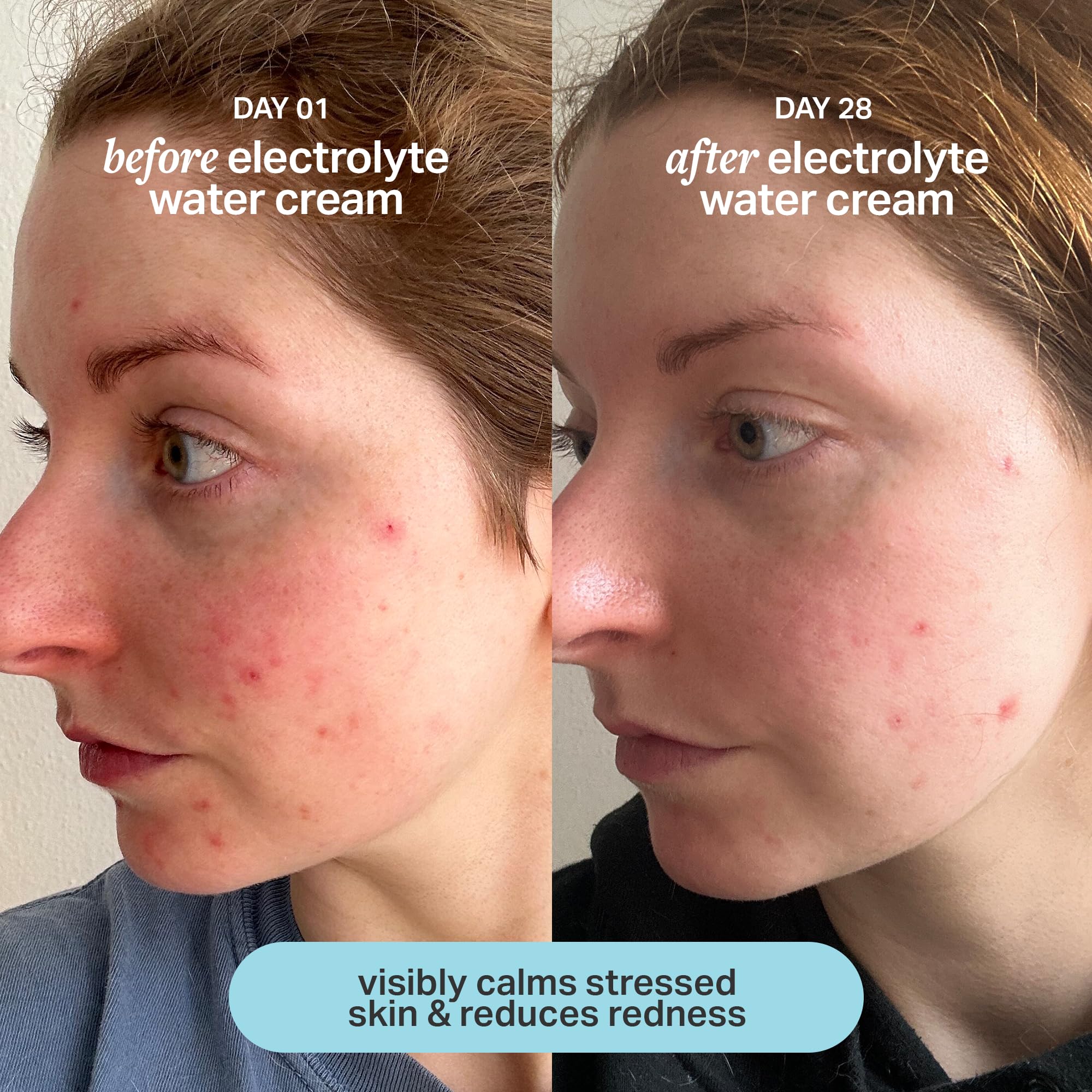 Cocokind Electrolyte Water Cream | Lightweight Hydration Gel for All Skin Types