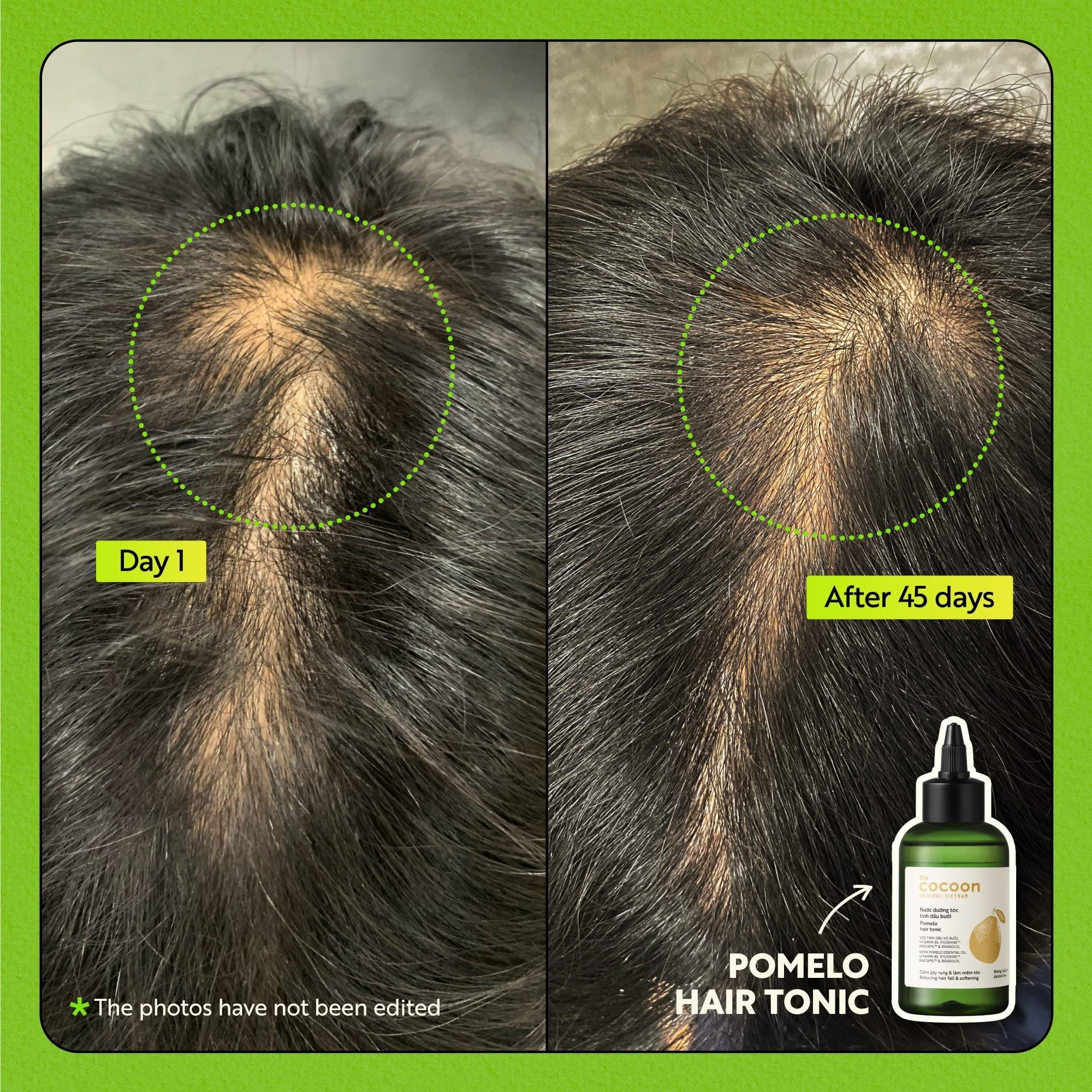 Cocoon Pomelo Hair Tonic – Vegan Scalp Serum for Thinning & Damaged Hair | COCOONORIGINAL (4.73 fl oz per bottle, 3 Boxes)