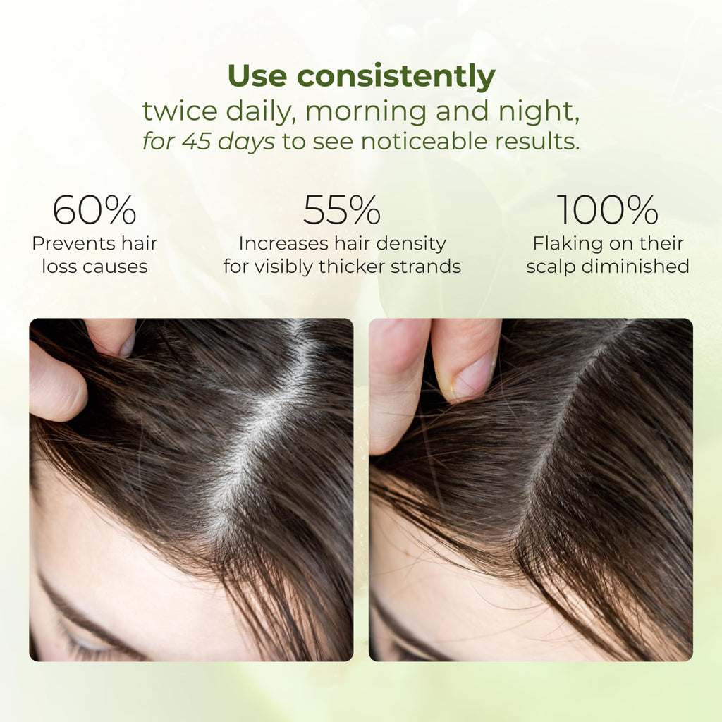 Cocoon Pomelo Hair Tonic – Vegan Scalp Serum for Thinning & Damaged Hair | COCOONORIGINAL (4.73 fl oz per bottle, 3 Boxes)