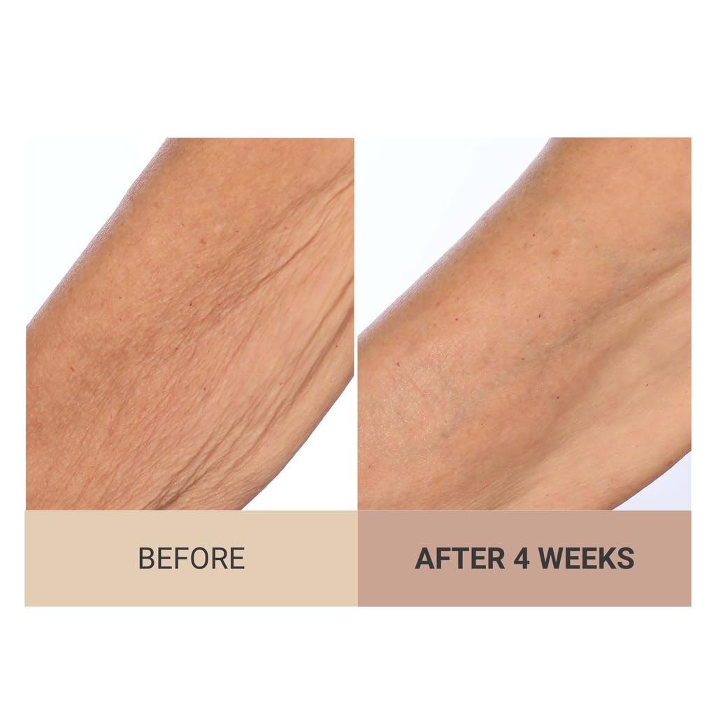 Consult Beaute Unscented Champagne Lift Hydrating Firming Body Cream with Pink PepperSlim – Tightens Crepey Skin & Hydrates Arms & Legs (8 oz)