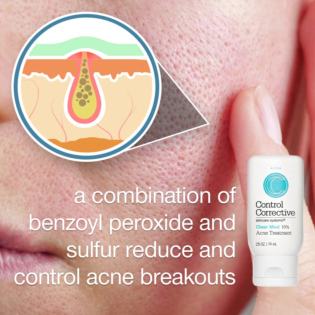 CONTROL CORRECTIVE Clear Med 10% Acne Treatment Lotion | 2.5 oz