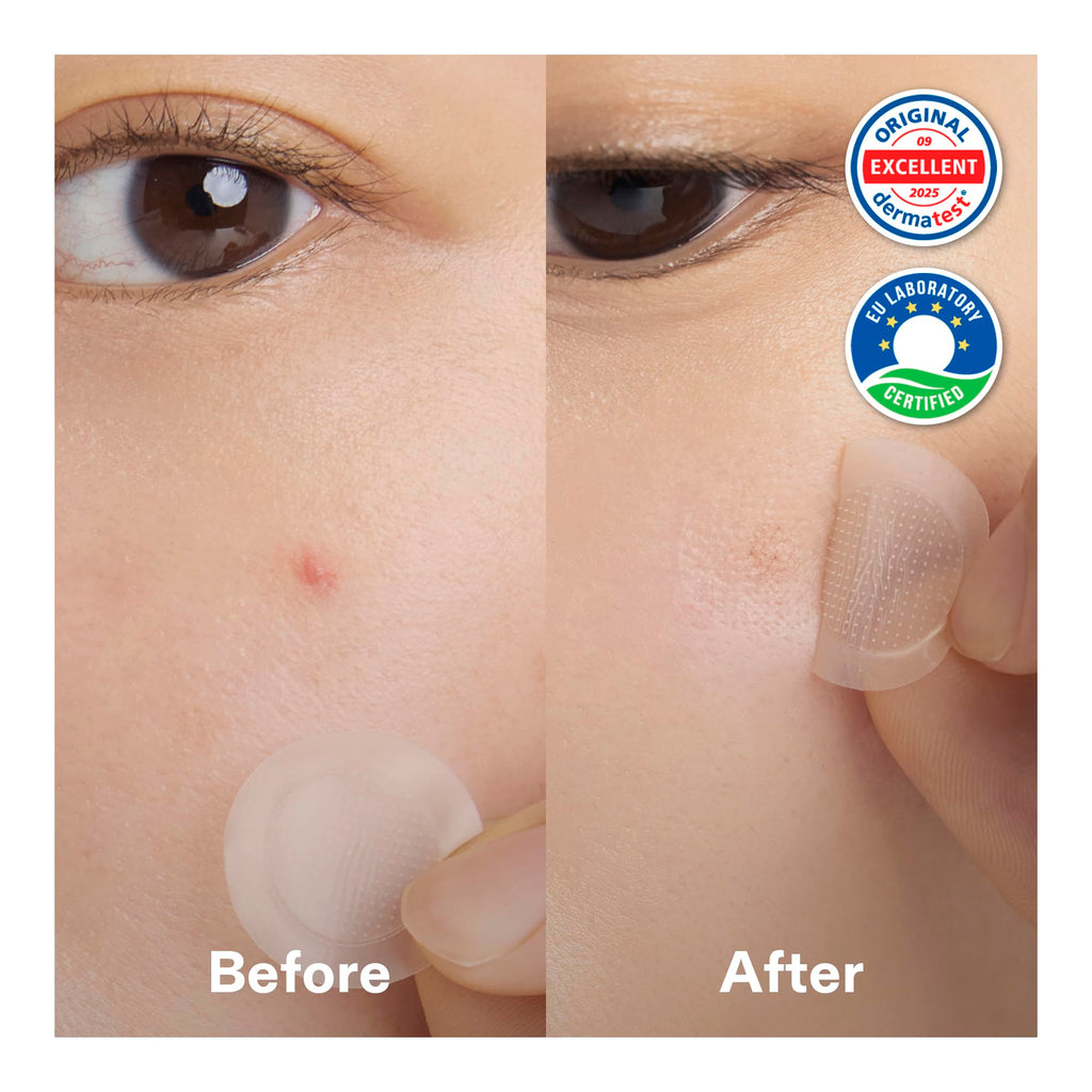 Cordiale Niacinamide Microdart Patches with Salicylic Acid & Peptide – Deep Blemish & Dark Spot Care (12 Count)