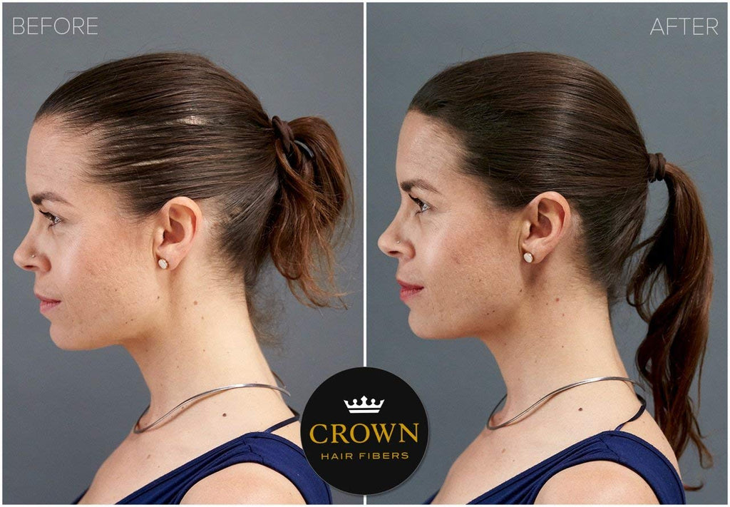 CROWN Hair Building Fibers (28g) – Instant Thinning Hair Concealment, 13 Shades