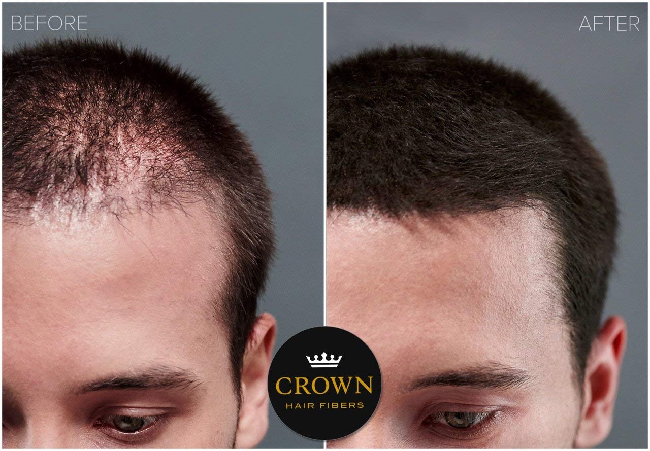 CROWN Hair Building Fibers (28g) – Instant Thinning Hair Concealment, 13 Shades