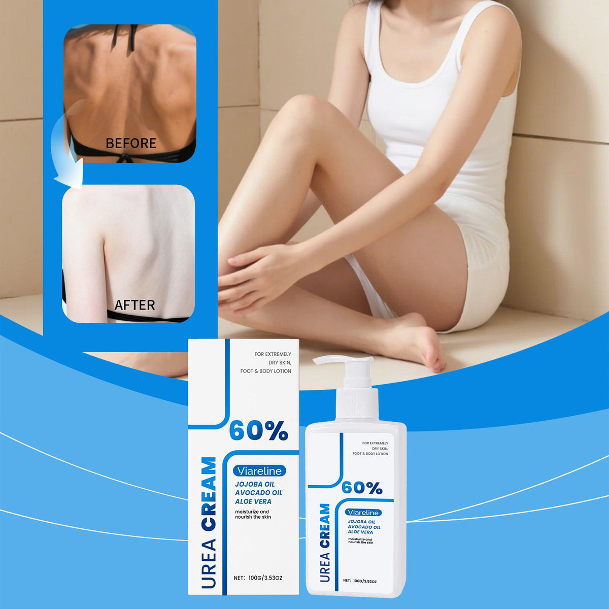 Urea Body Lotion