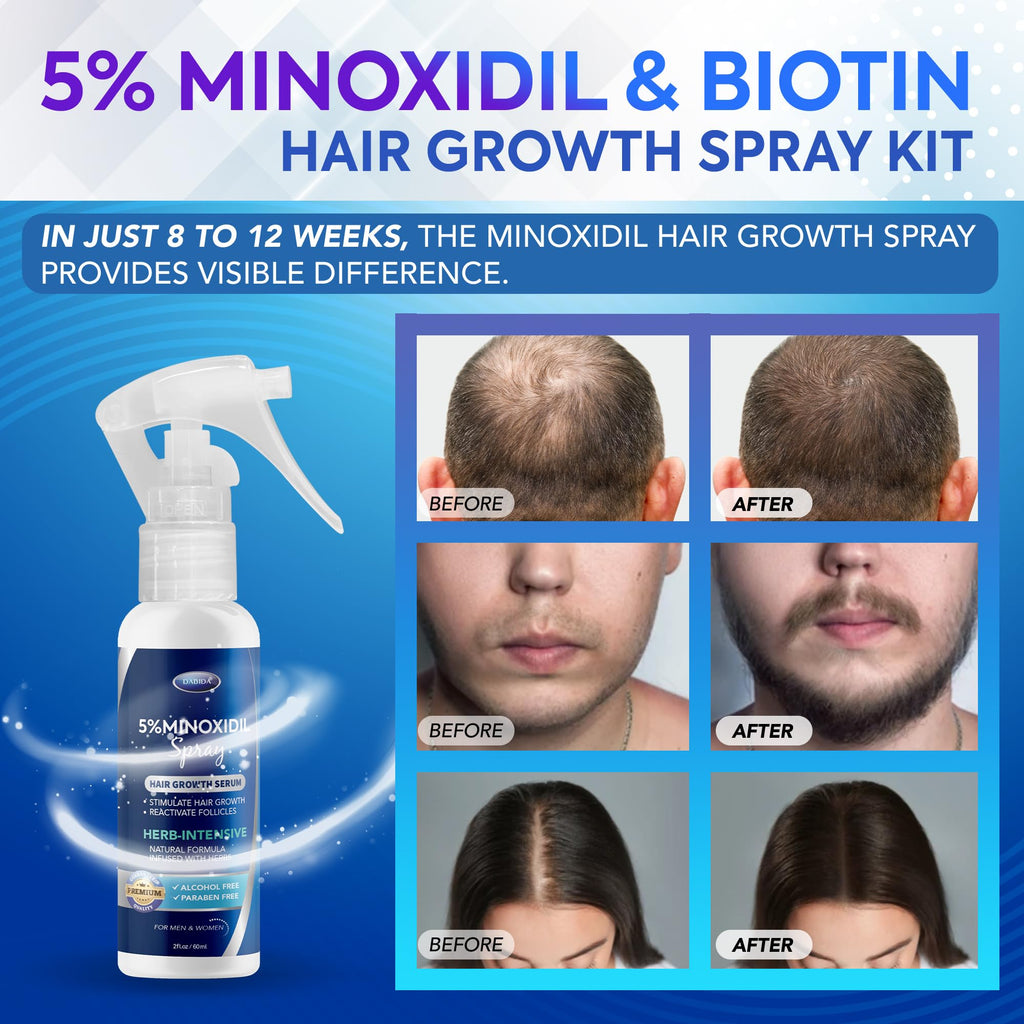 DABIDA 5% Minoxidil Spray for Men & Women – Hair Growth & Beard Growth, 3x60ml