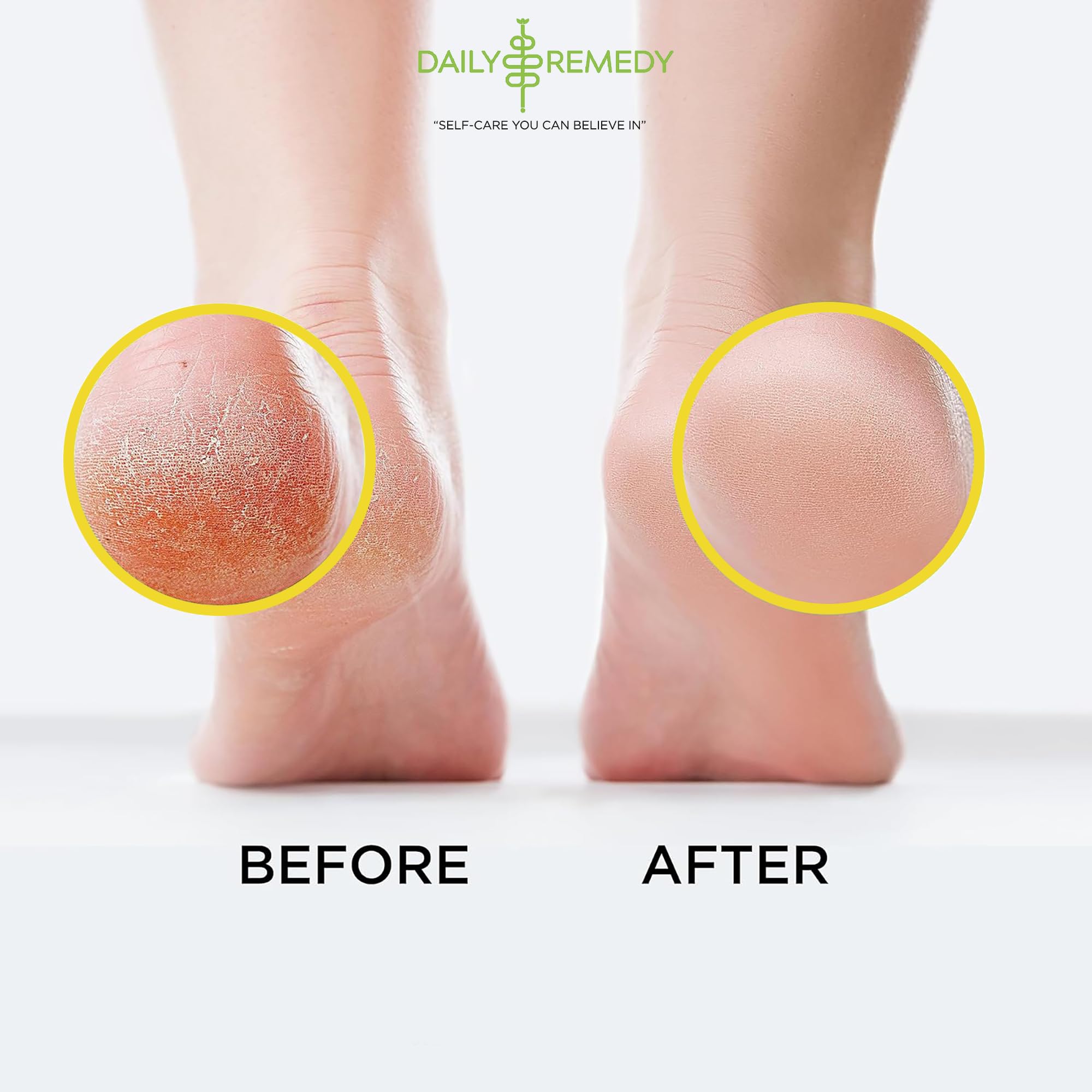 Daily Remedy Citrus Detox Foot Soak with Epsom Salt | Foot Care Pedicure | Made in USA