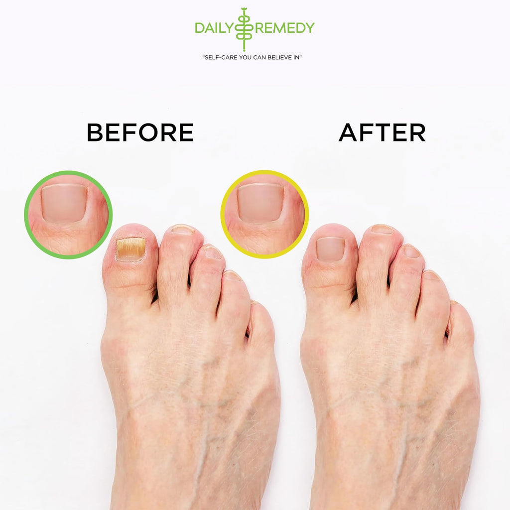 DAILY REMEDY 4-Pack Foot Soak Set – Extra Strength Tea Tree Oil & Citrus Detox | Made in USA