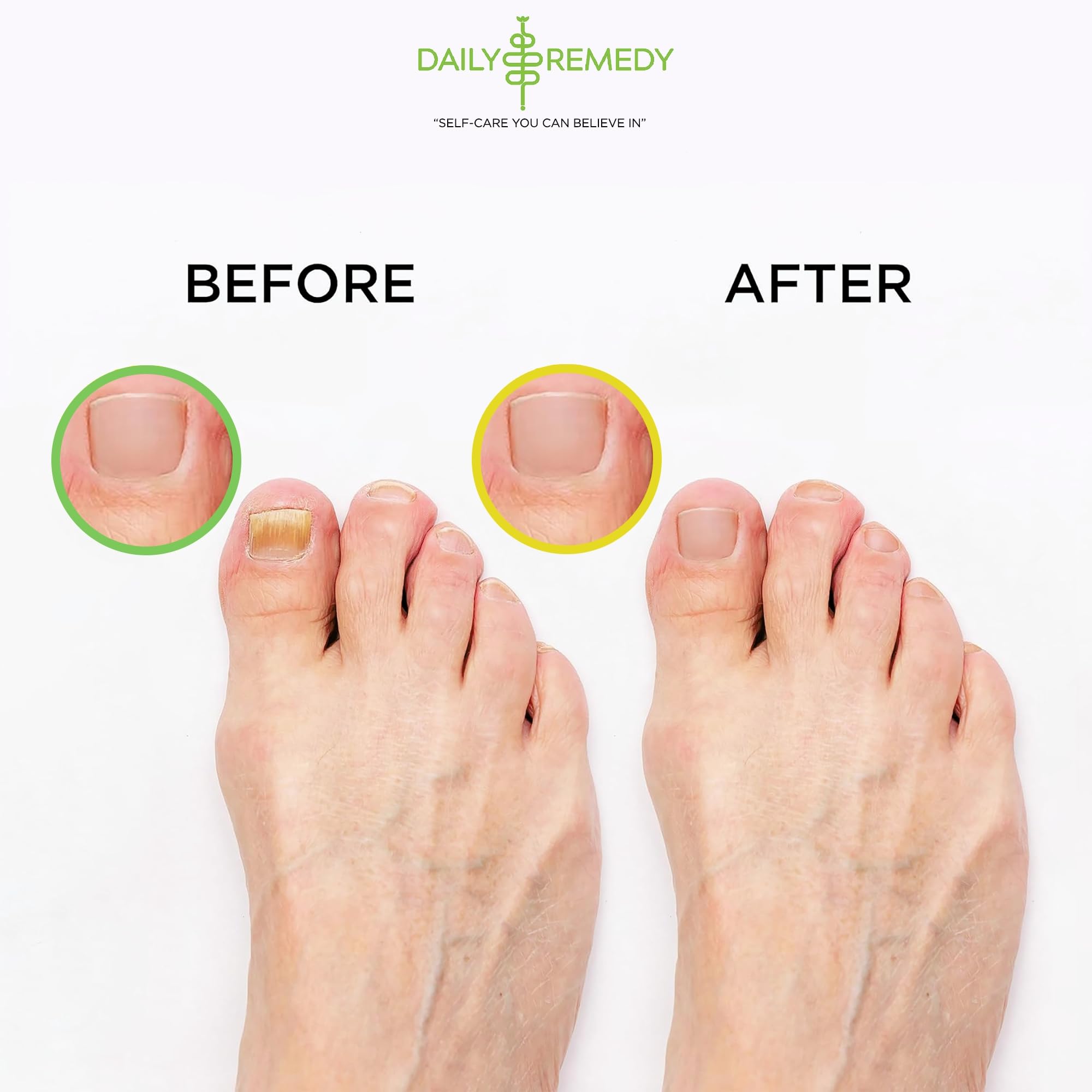 DAILY REMEDY 4-Pack Foot Soak Set – Extra Strength Tea Tree Oil & Citrus Detox | Made in USA