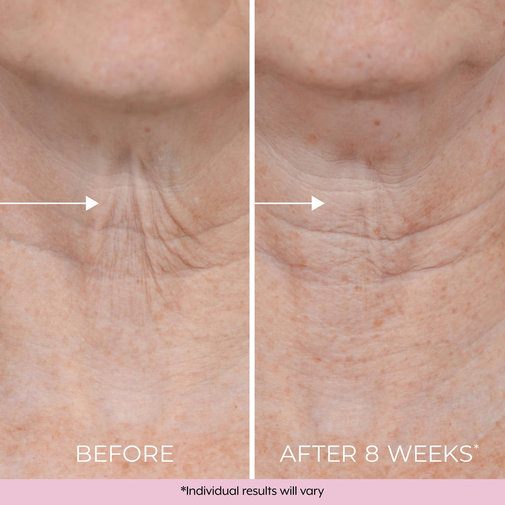 DEKLIDERM Neck Firming Cream – Retinol & Bakuchiol for Neck Lines & Firmness