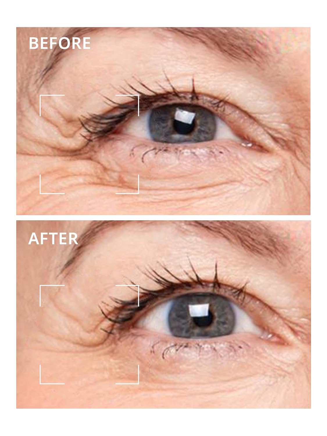 depology Deepcare+ Serum-Infused Micro Dart Patches – Hydrating Eye Patches with Peptides (12 Pairs)