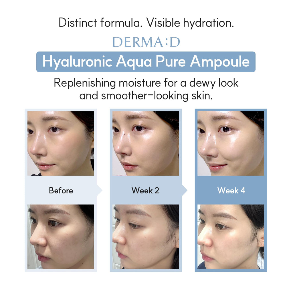 DERMA:D Korean Ampoule with Hyaluronic Acid – Hydrating Serum with Vitamin C, Retinol, Panthenol | 1.69 fl oz