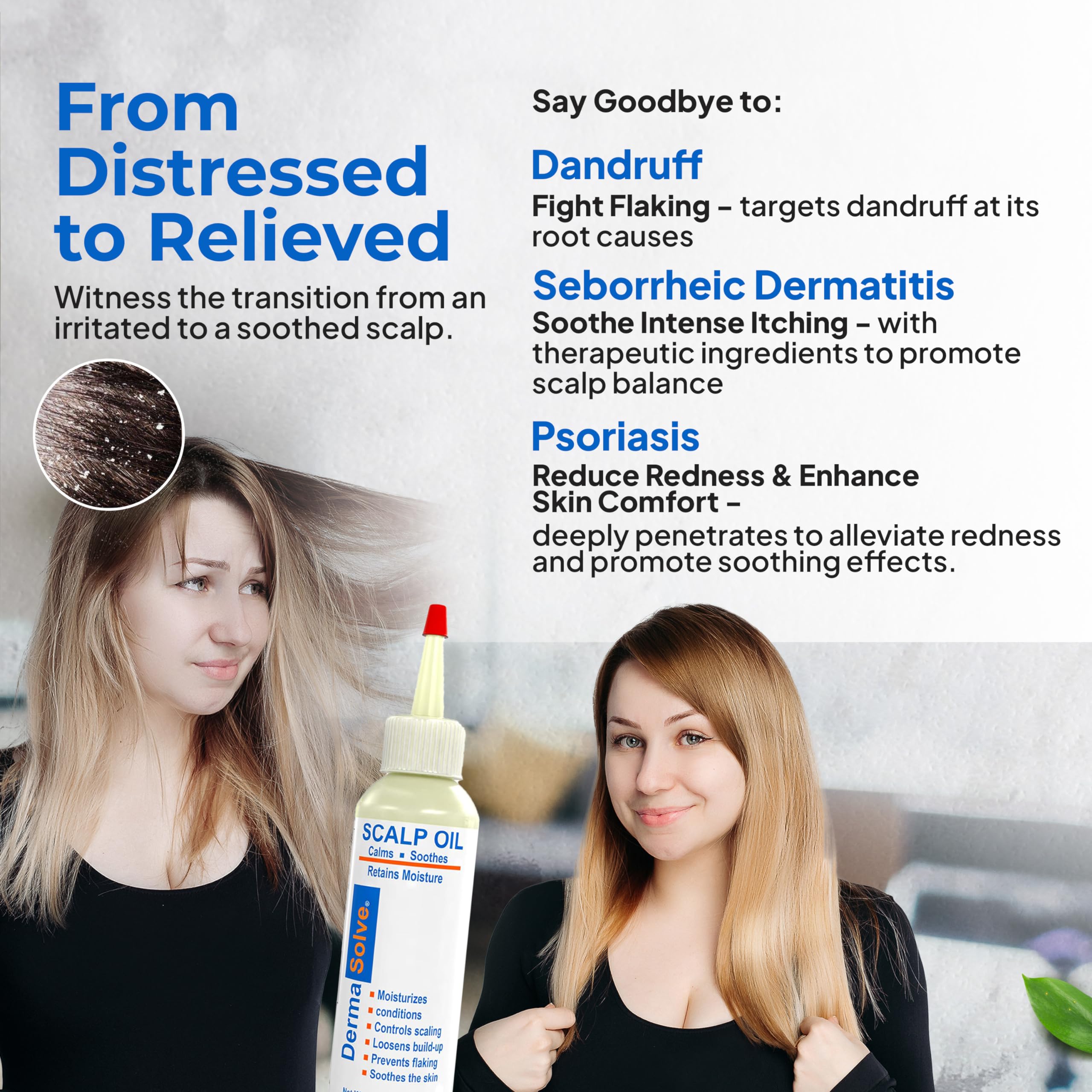 Dermasolve Psoriasis & Dandruff Oil – Dermatologist-Approved Scalp Relief