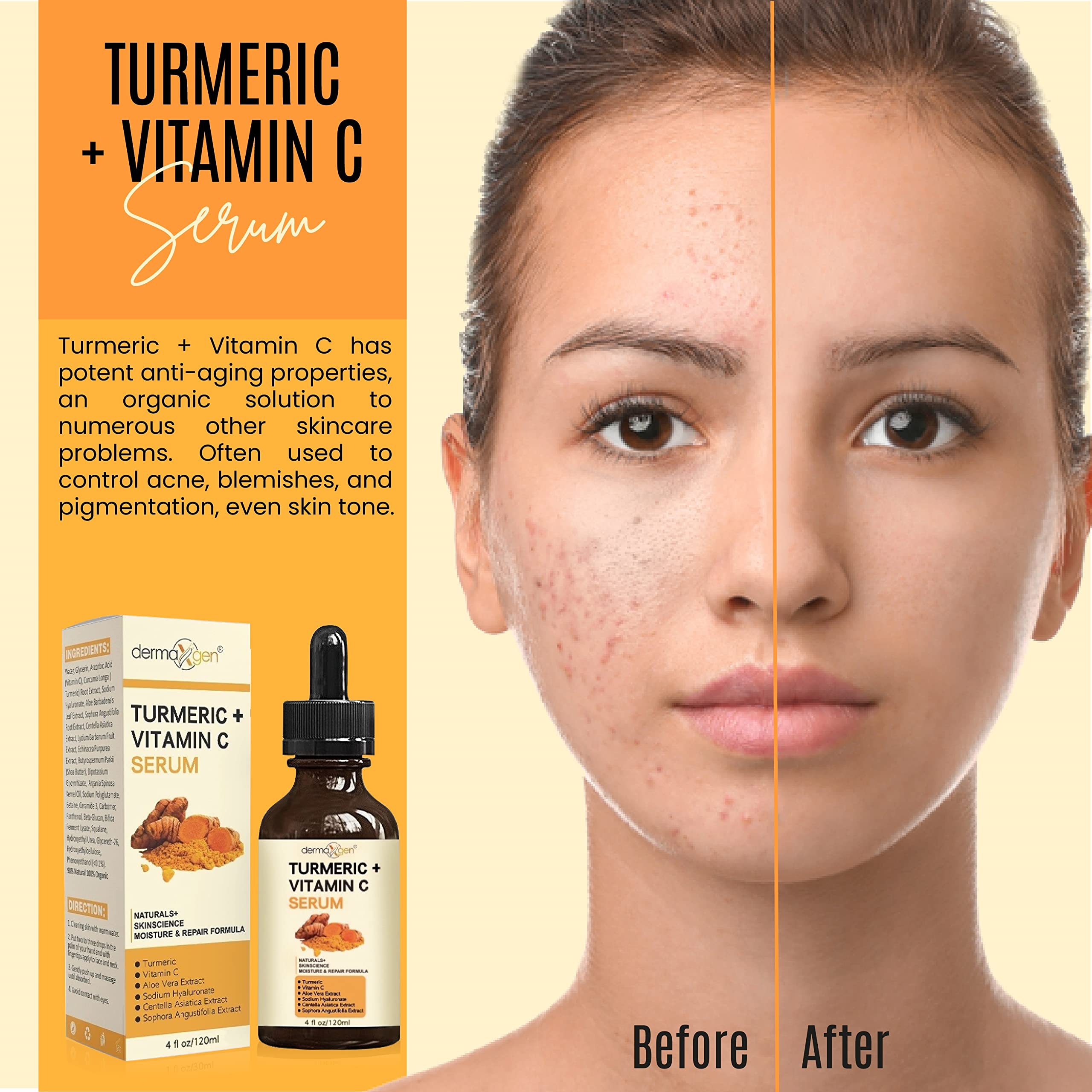 DERMAXGEN Turmeric Serum + Vitamin C — Glow-Boosting Organic Moisturizer (4 oz)