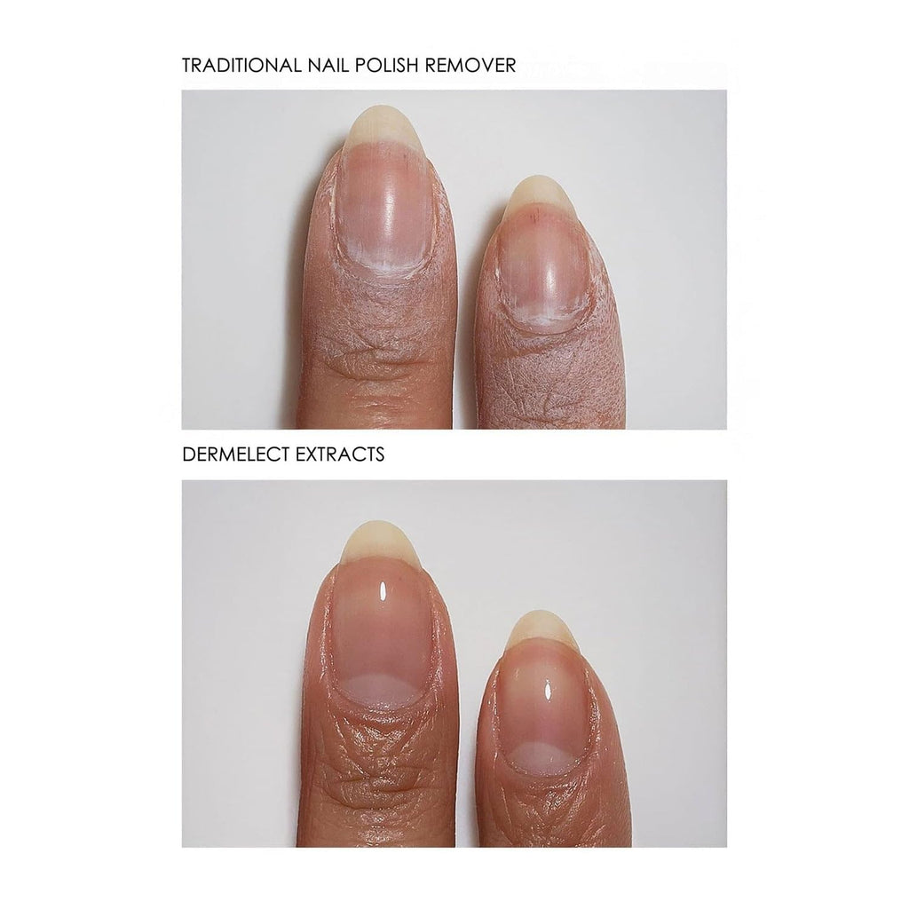 Dermelect Clean & Care Nail Renewal Kit – 3‑Step Nail Care for Strength, Brightness & Repair