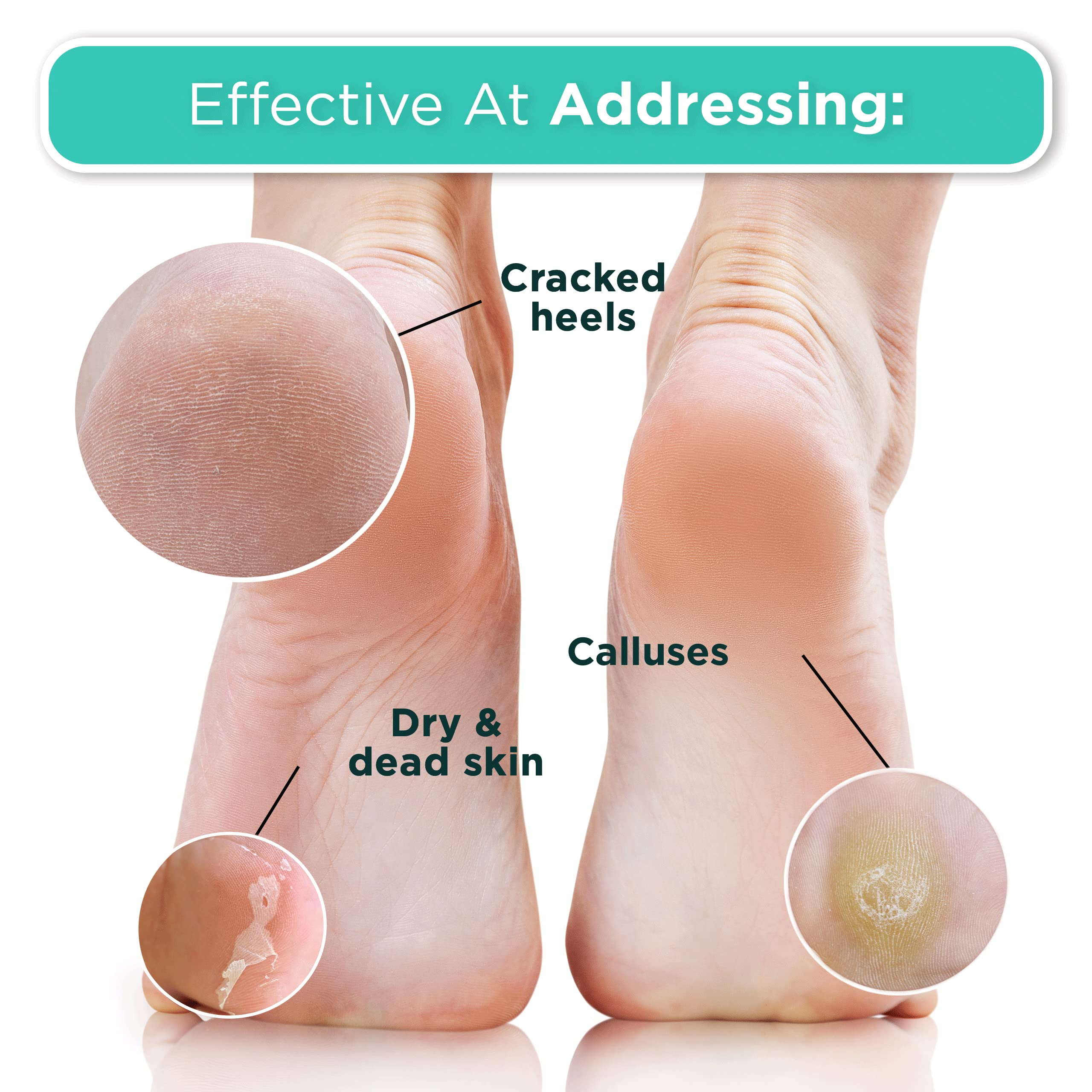 DERMORA Foot Peel Mask | Exfoliating Foot Masks for Soft Feet | Pack of 4 | Original Scent