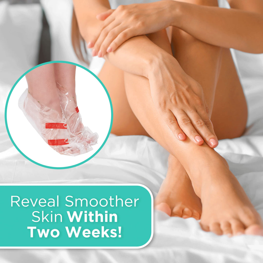 DERMORA Foot Peel Mask | Exfoliating Foot Masks for Soft Feet | Pack of 4 | Original Scent