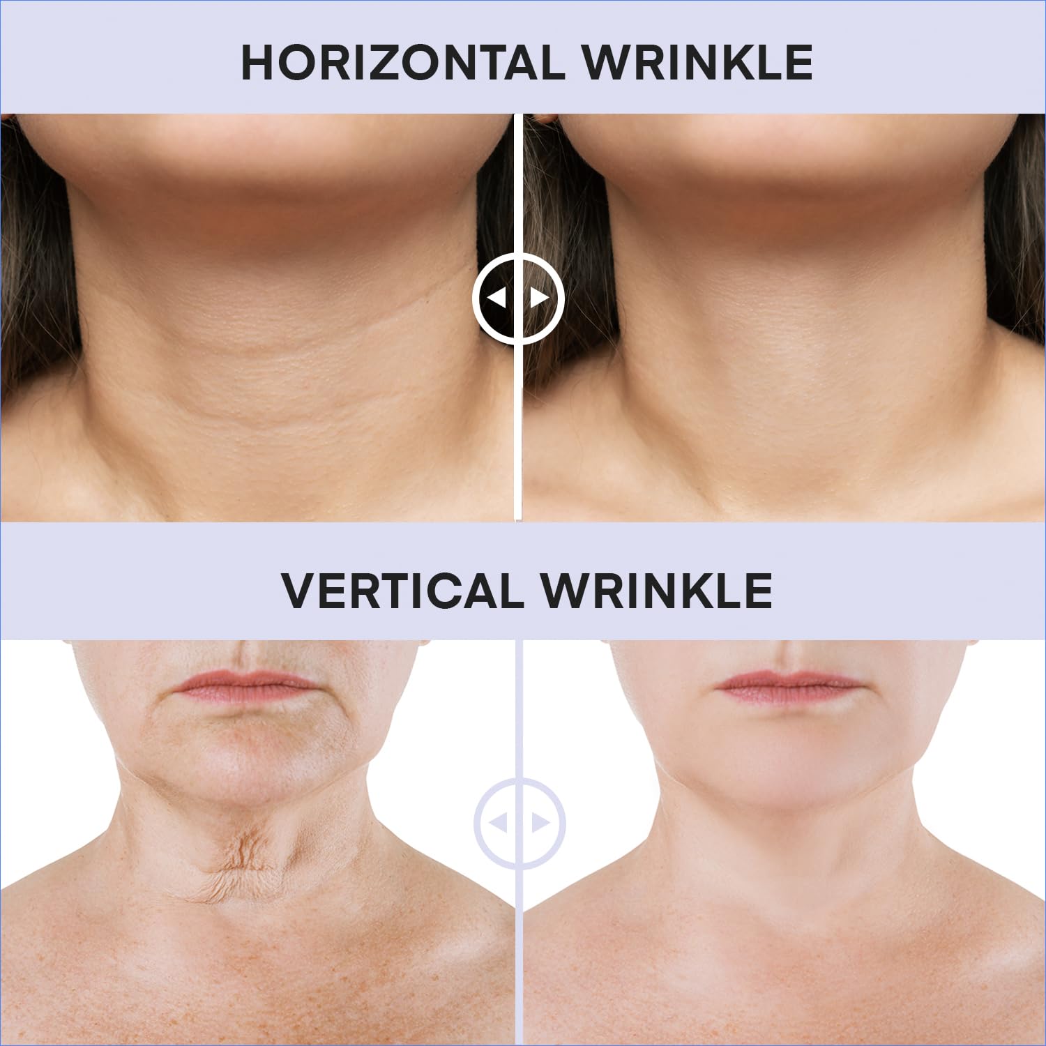 DERPHEA Neck Cream for Tightening & Firming – Advanced Neck Lift, 3.4 oz