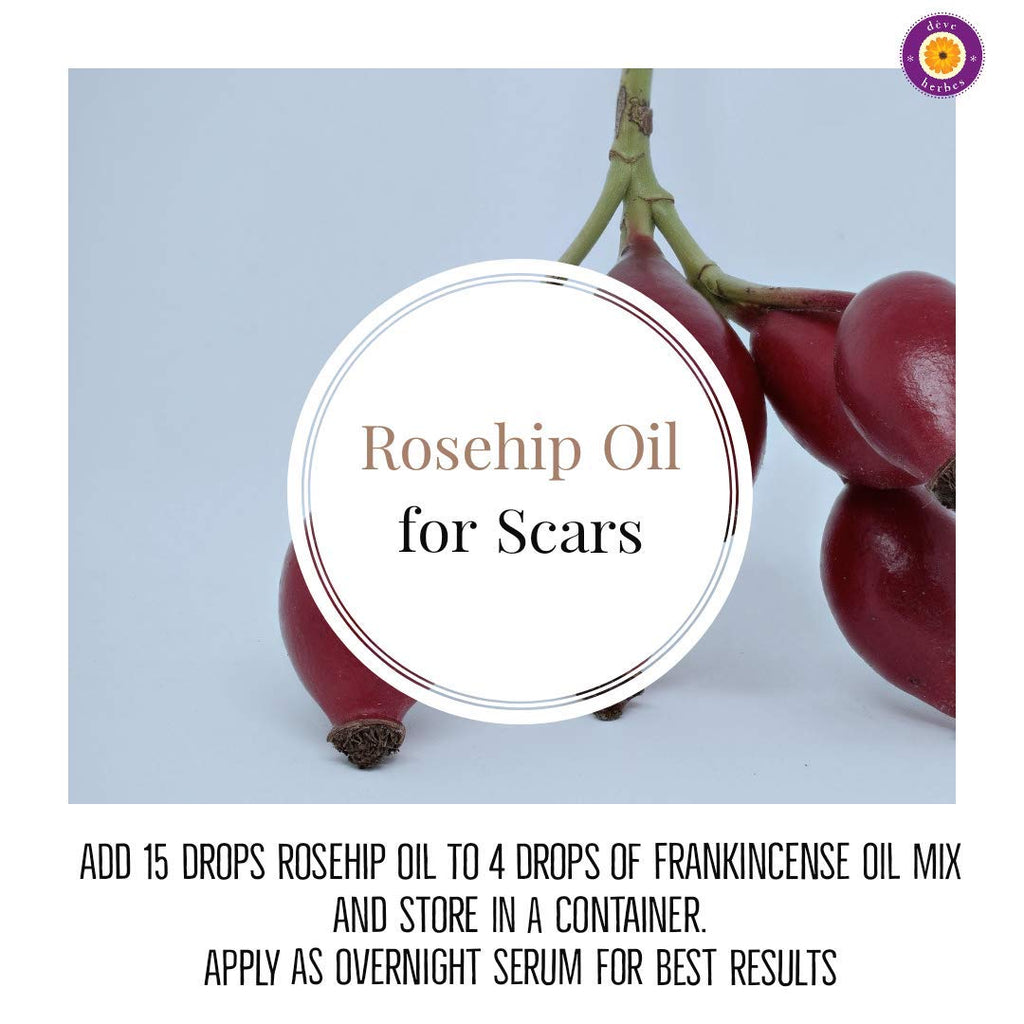 dève herbes Pure Rosehip Oil (Rosa rubiginosa) Cold-Pressed 30ml – All Skin Types