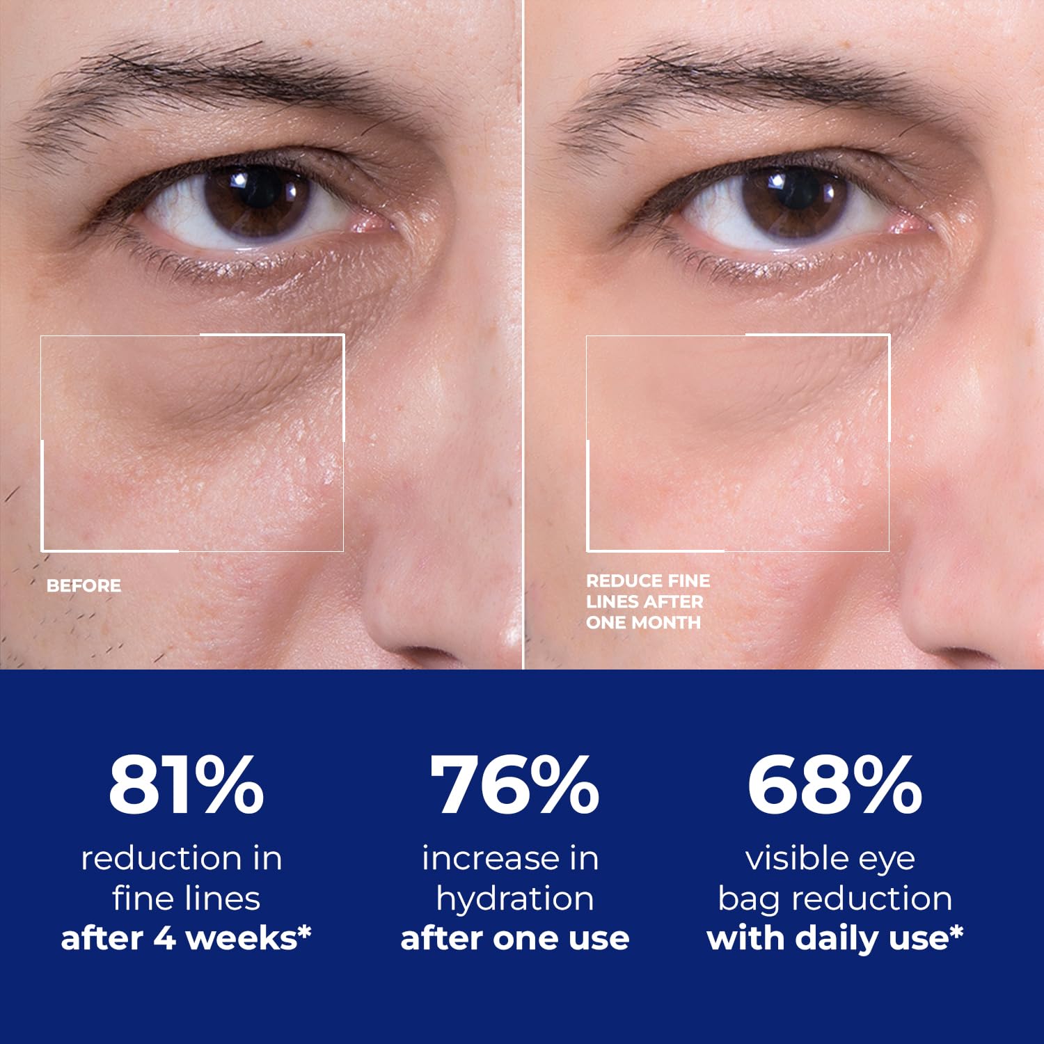 DIPSEVEN Men's Eye Cream - Under Eye Treatment for Bags, Wrinkles & Dark Circles - Peptides + Hyaluronic Acid