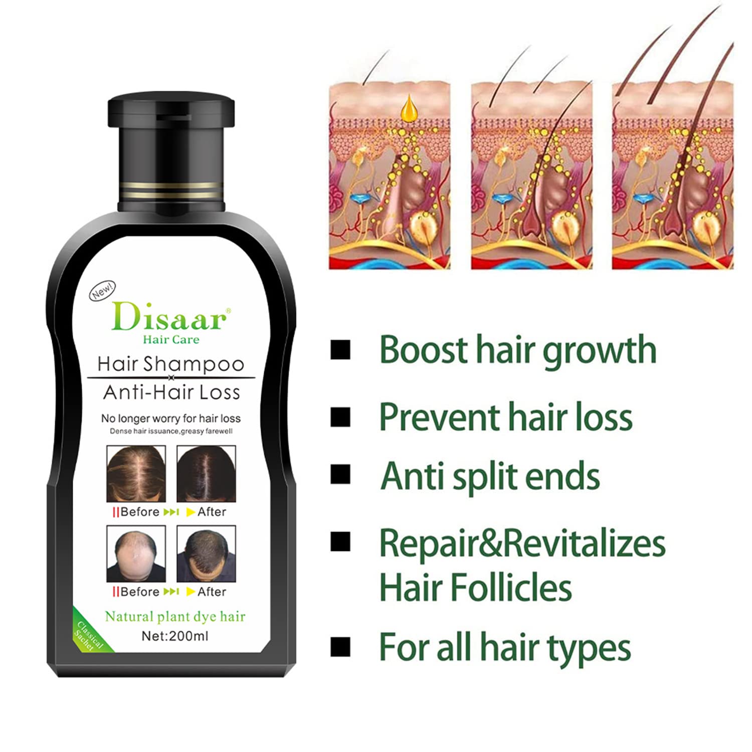 DISAAR Beauty Anti-Hair-Loss Shampoo & Growth Serum 200ml – Herbal Scalp Care & Regrowth Support