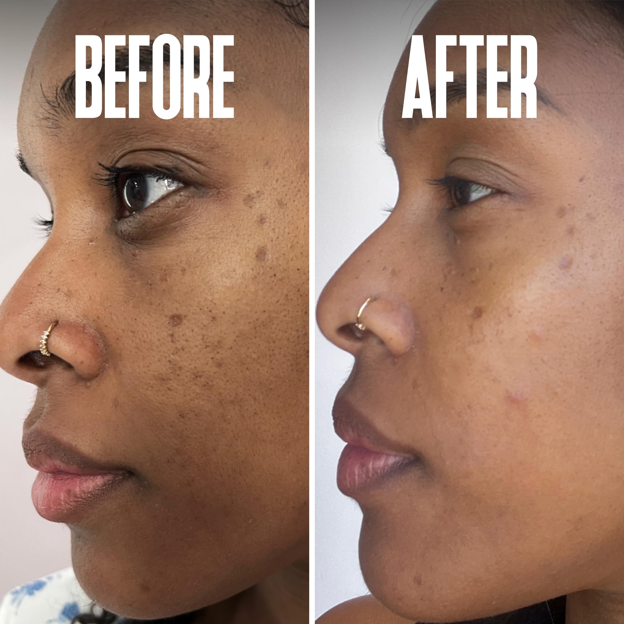 Divine Derriere Dark Spot Corrector Serum – Kojic Acid, Alpha Arbutin & Mulberry