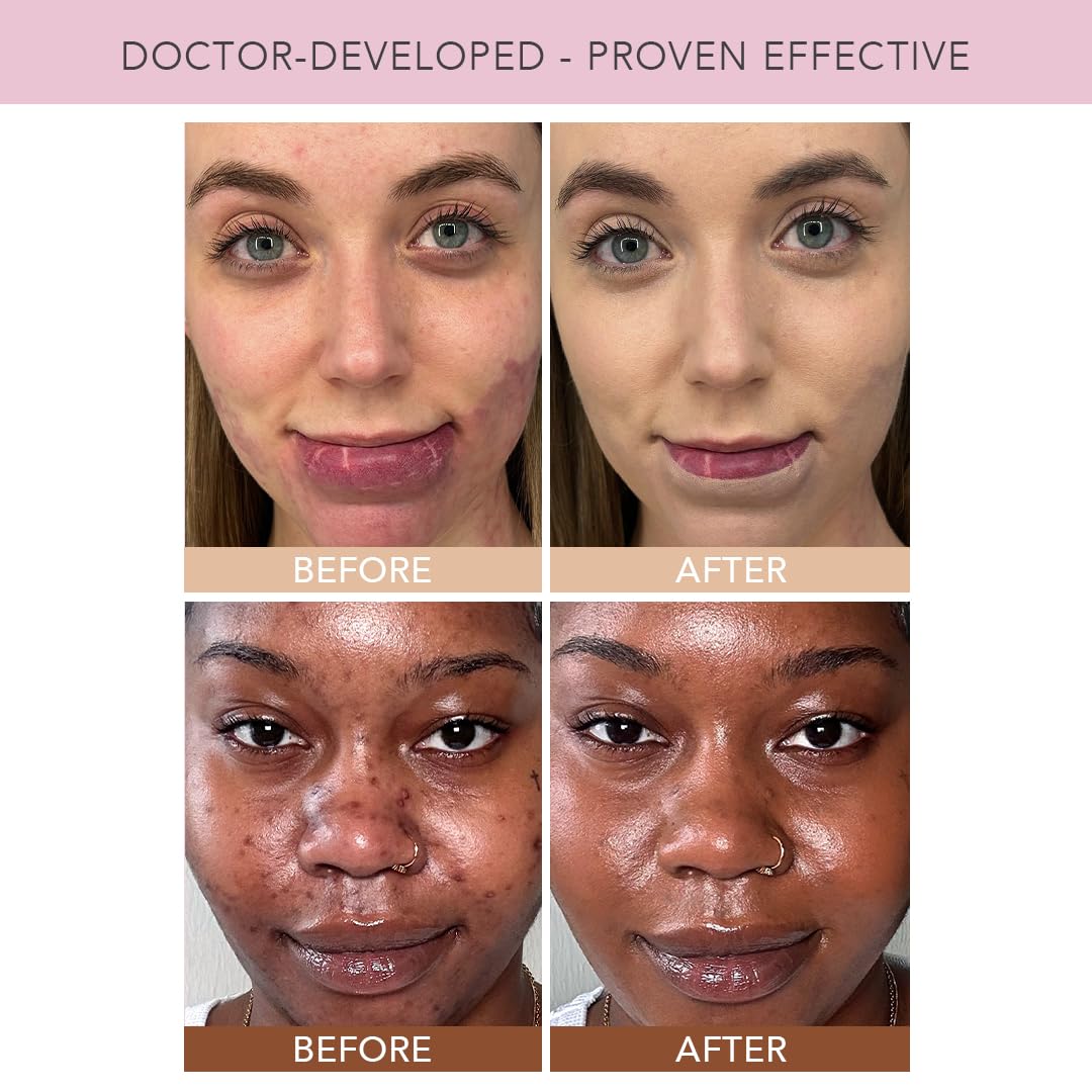 Doll 10 NO TCE Liquid Filter – CC Cream & Lightweight Skin Tint (Tan/Deep) | Vegan, Clean Makeup