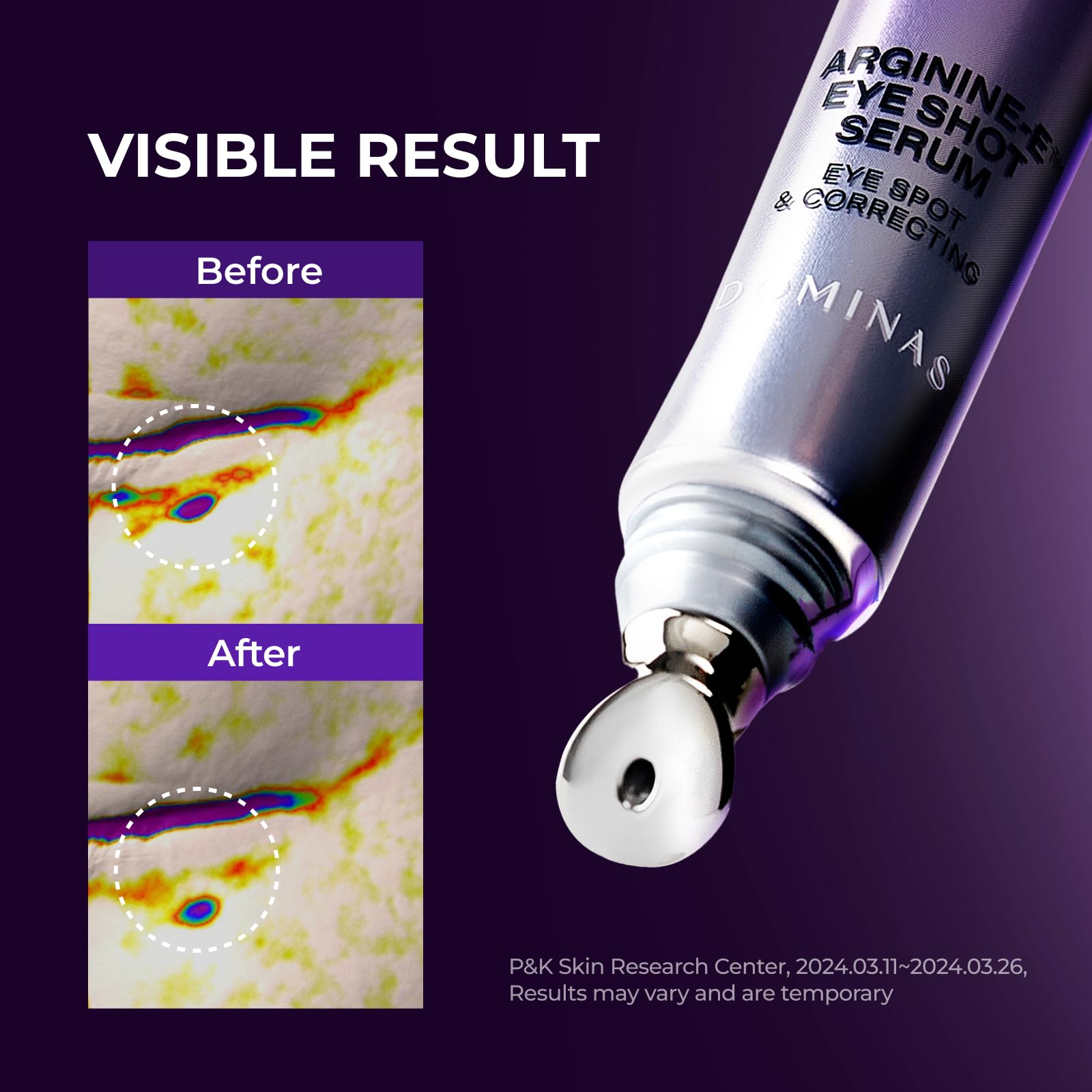 DOMINAS AtClinic Arginine-E Eye Shot Serum – Puffiness Reducer with Caffeine, Niacinamide & Cooling Guasha Tip