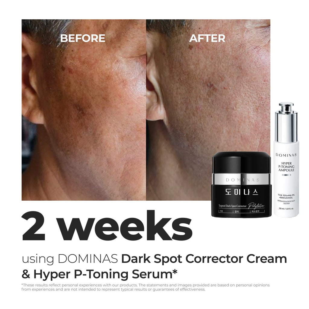 DOMINAS Dark Spot Corrector Cream – Brightening with TXA, Niacinamide & Bakuchiol | 1.76 oz