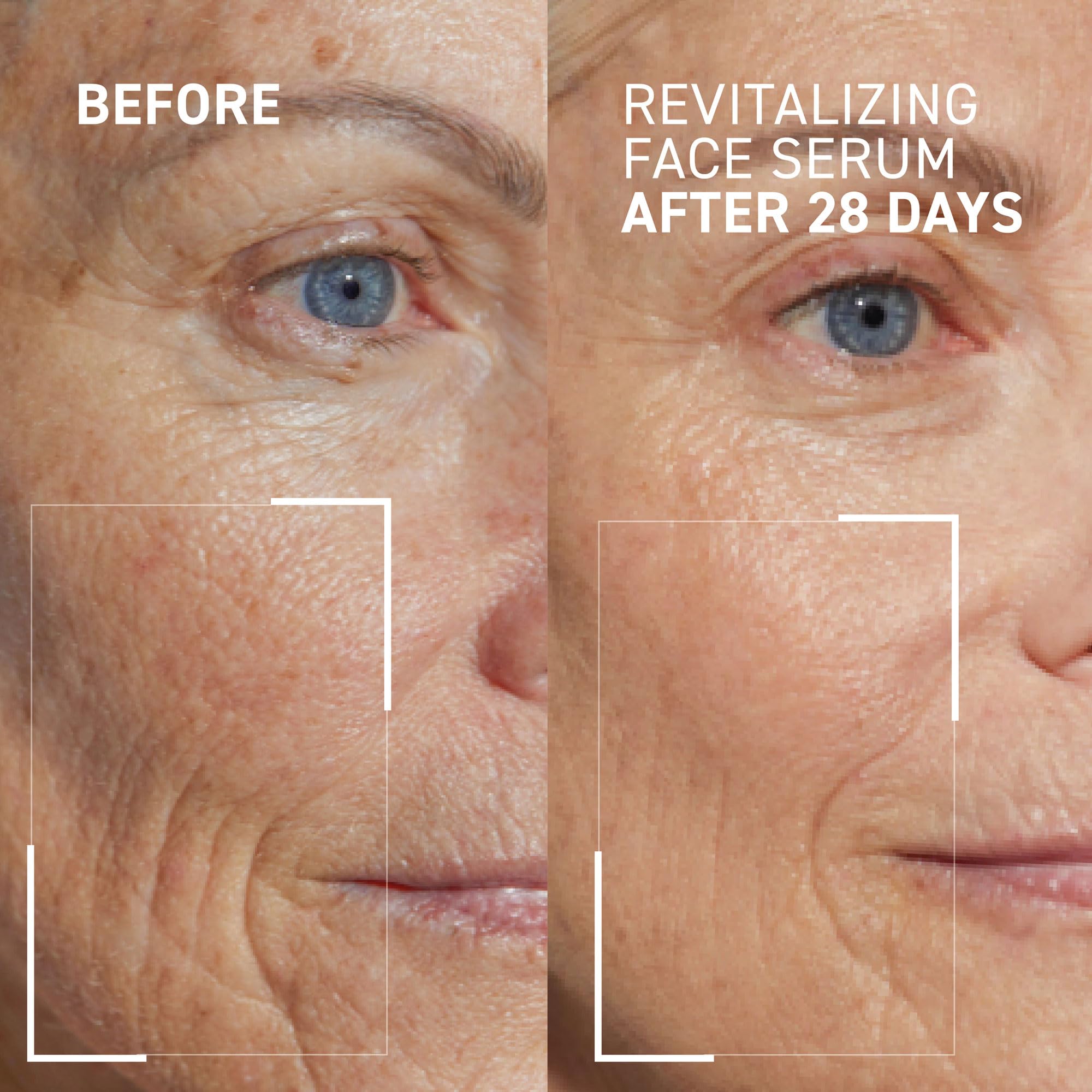 Dr Brandt Dare to Age Revitalizing Face Serum - Smooths Lines, Restores Radiance - 1 fl oz (Pack of 2)