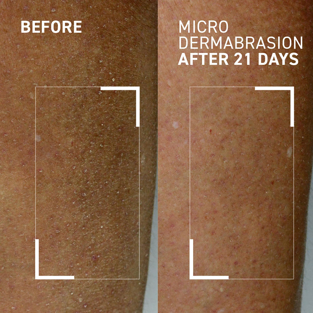 Dr. Brandt Microdermabrasion Hydrating Body Exfoliator – Renew Rough, Dry Skin (4.2 oz, Pack of 2)