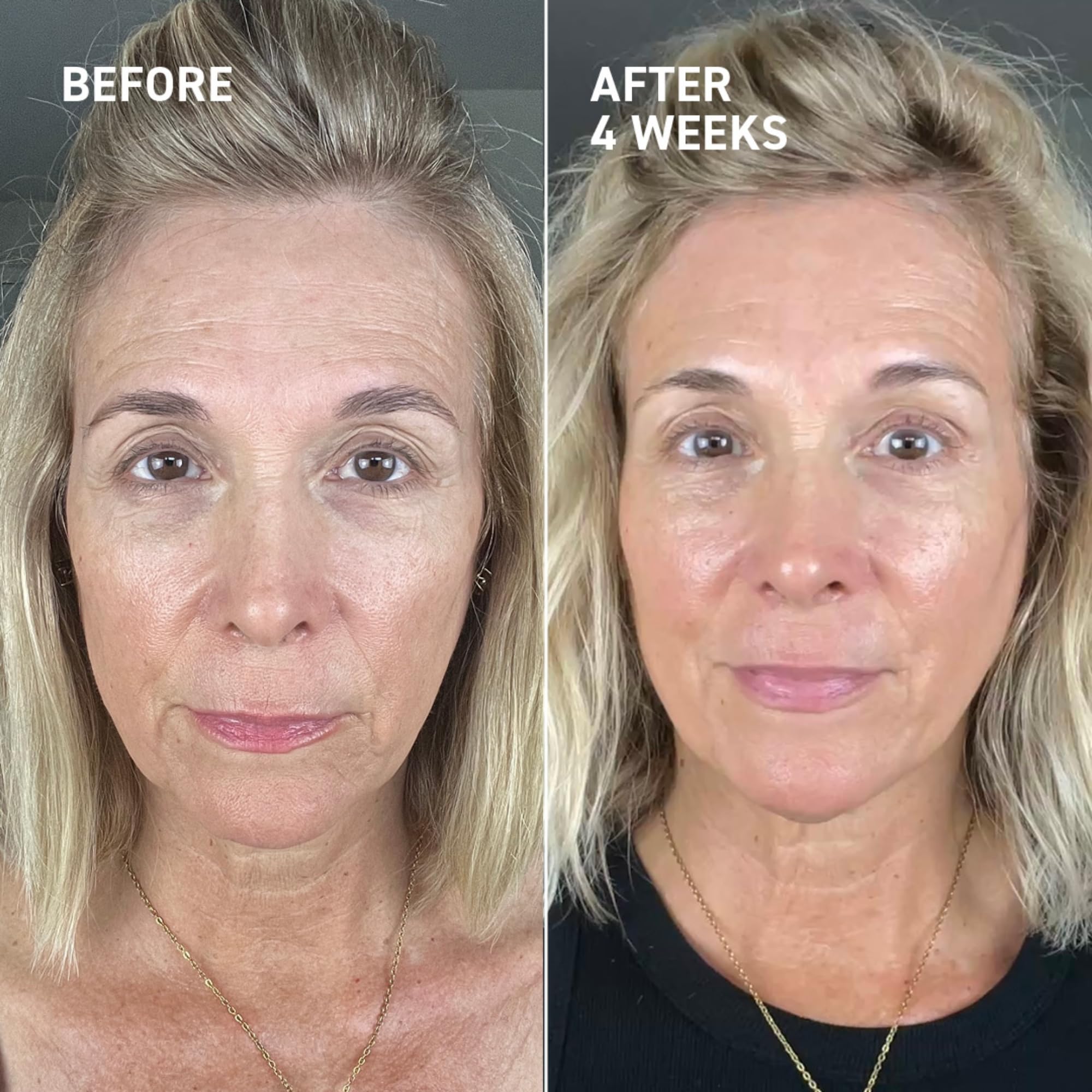 Dr. Brandt Needles No More Dermal Micro Points – Intensive Skin-Lifting Gel for Texture & Fine Lines | 1.0 oz