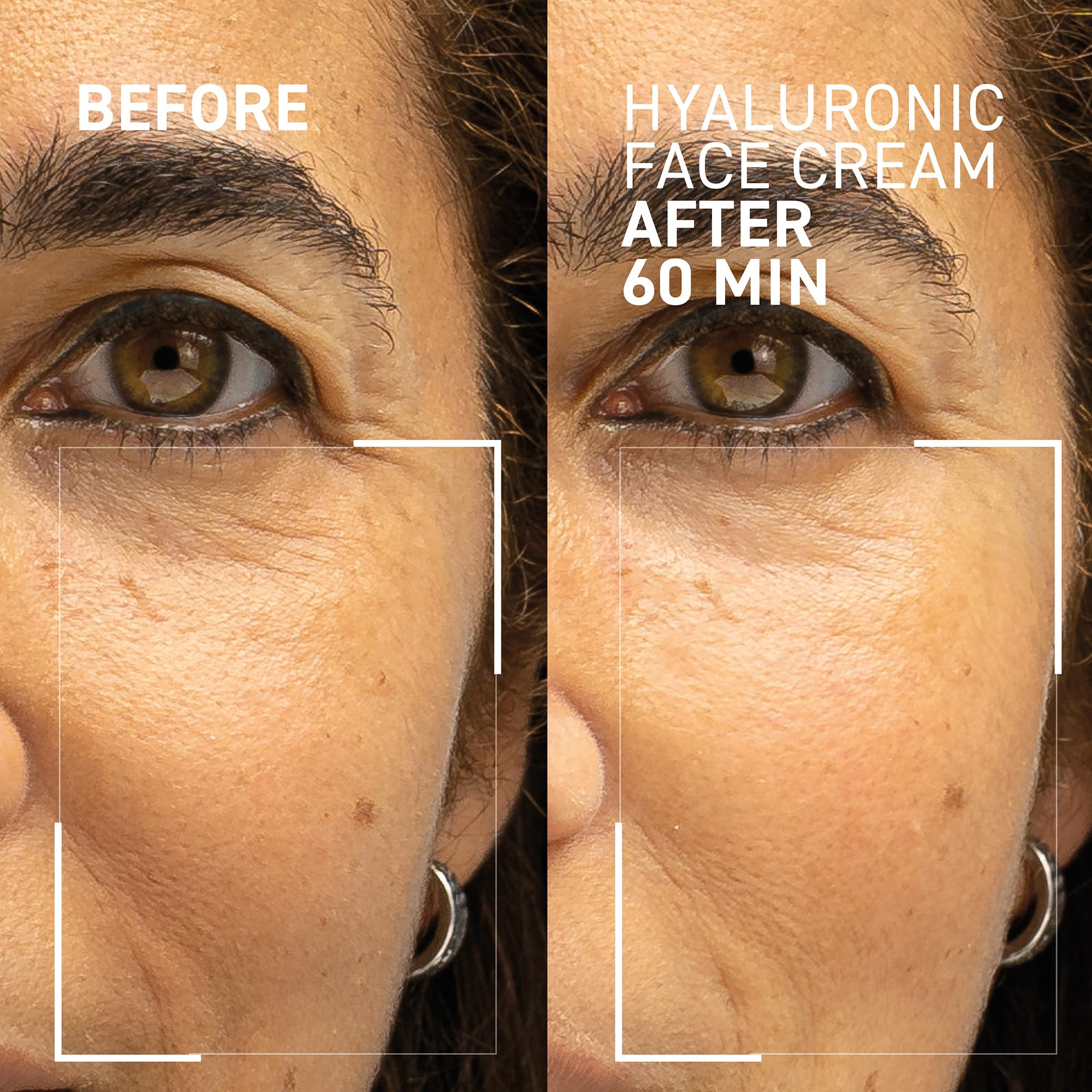 Dr. Brandt Needles No More Hyaluronic Face Cream – Long-Lasting Hydration for Dehydrated Skin | 1.7 oz Pack of 2