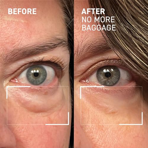 Dr. Brandt Needles No More Baggage – 0.23 oz Pack of 2 | Eye De-Puffing Gel for Bags, Puffiness & Dark Circles