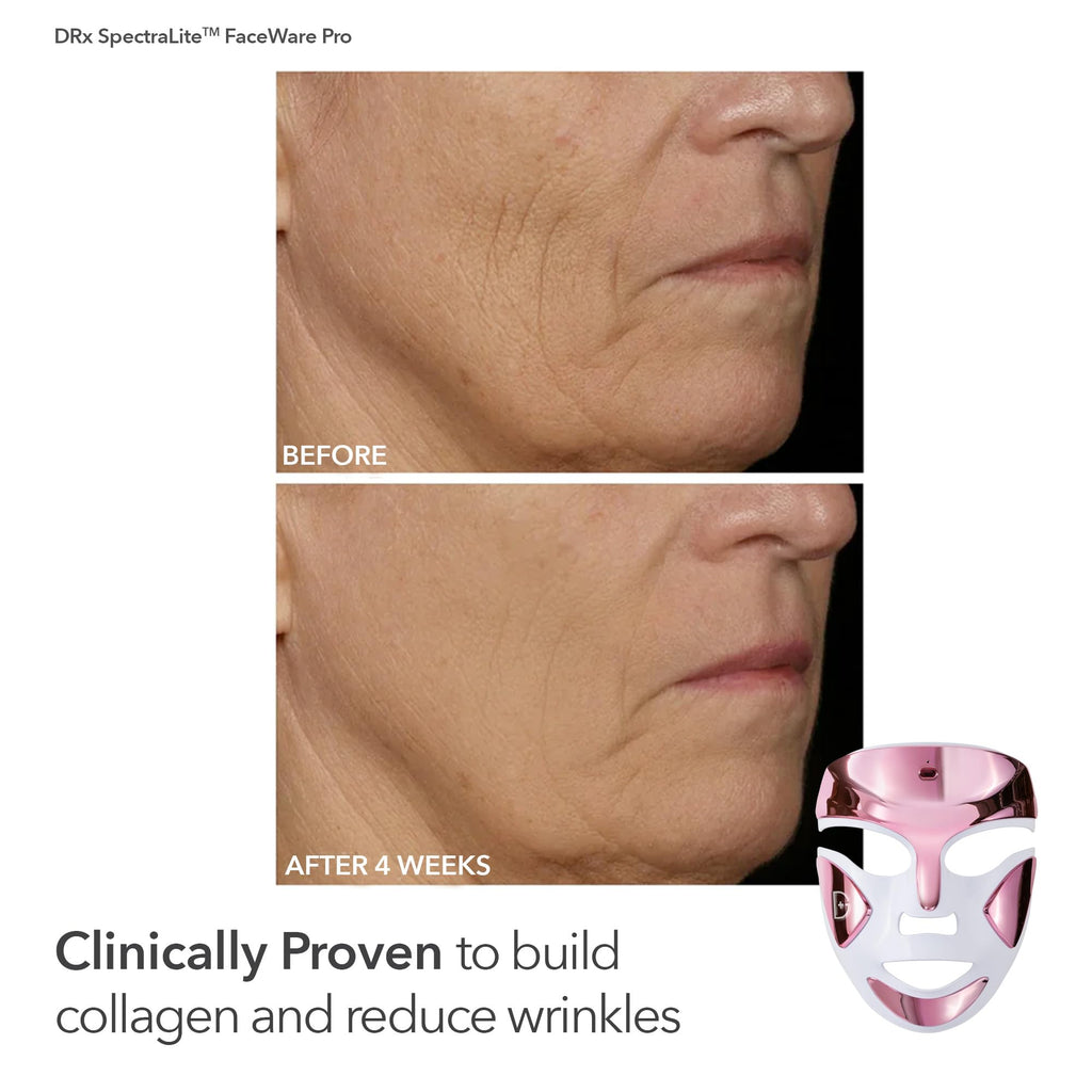 Dr Dennis Gross dpl FaceWare Pro Pink LED Mask Gift Set – Collagen, Brightening & Firming with Cleansing Oil, Dewy Deep Cream & 5 Universal Daily Peels | $592 Value
