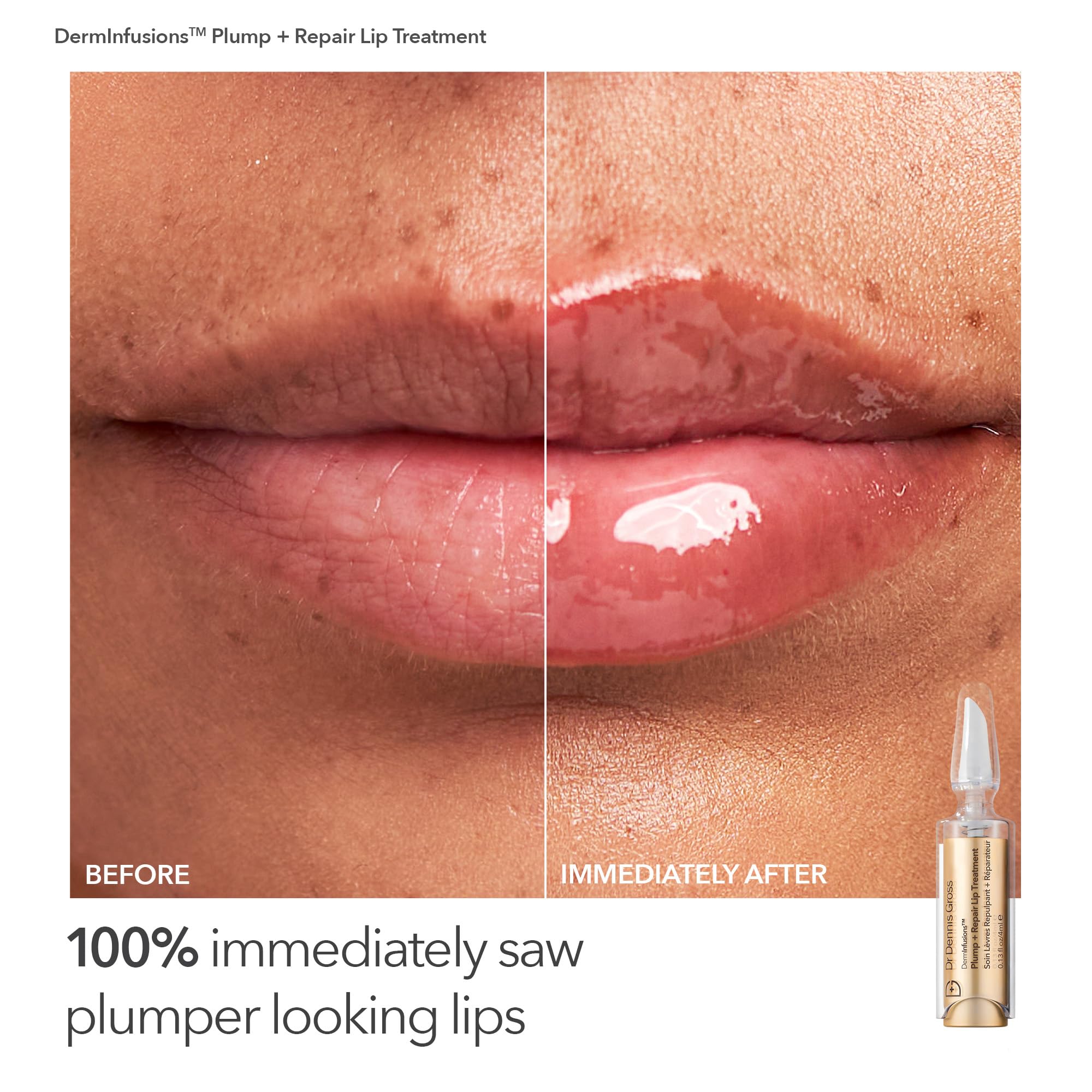 Dr Dennis Gross Fill, Plump & Firm Kit | DermInfusions Hyaluronic Serum, Eye & Lip